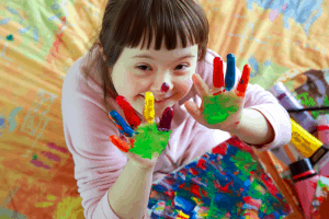 18 Down Syndrome Facts  Signs Causes Treatment  More 