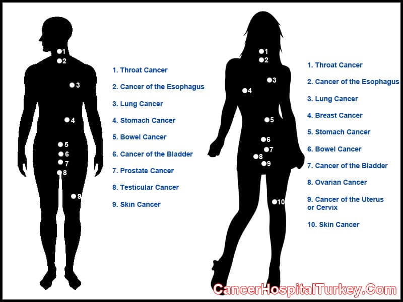 Types of Cancer by Sex