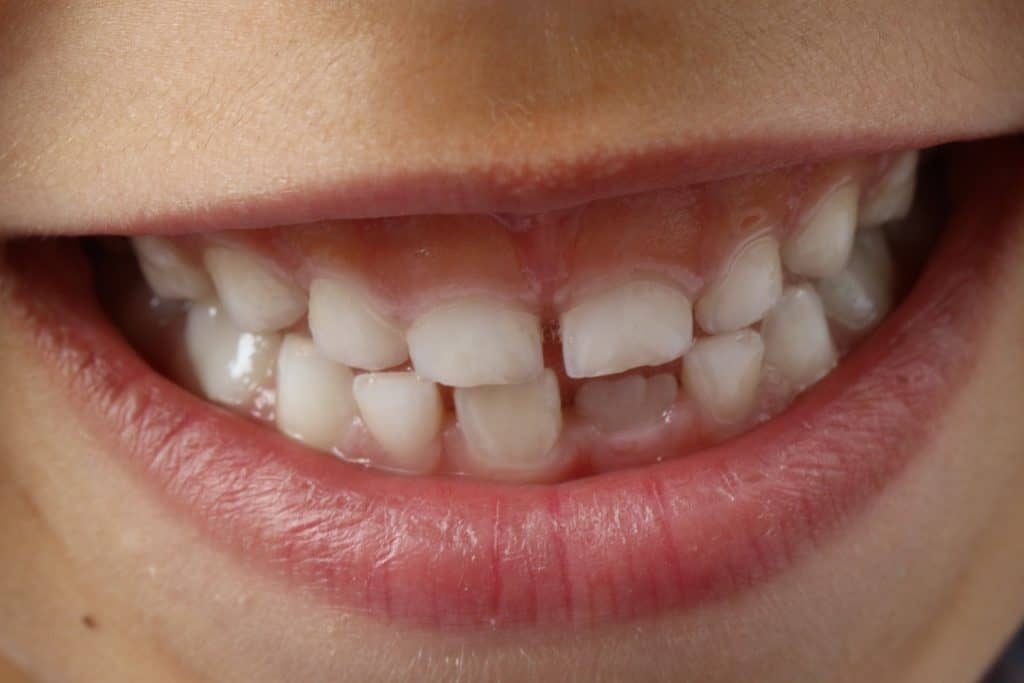 crazy facts tooth