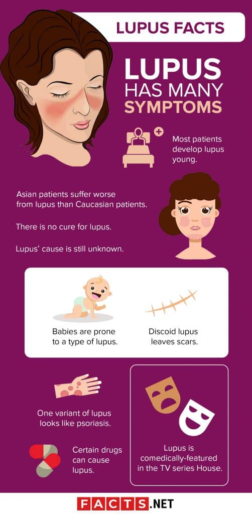 systemic-lupus-erythematosus-houston-tx-rheumatology-infectious