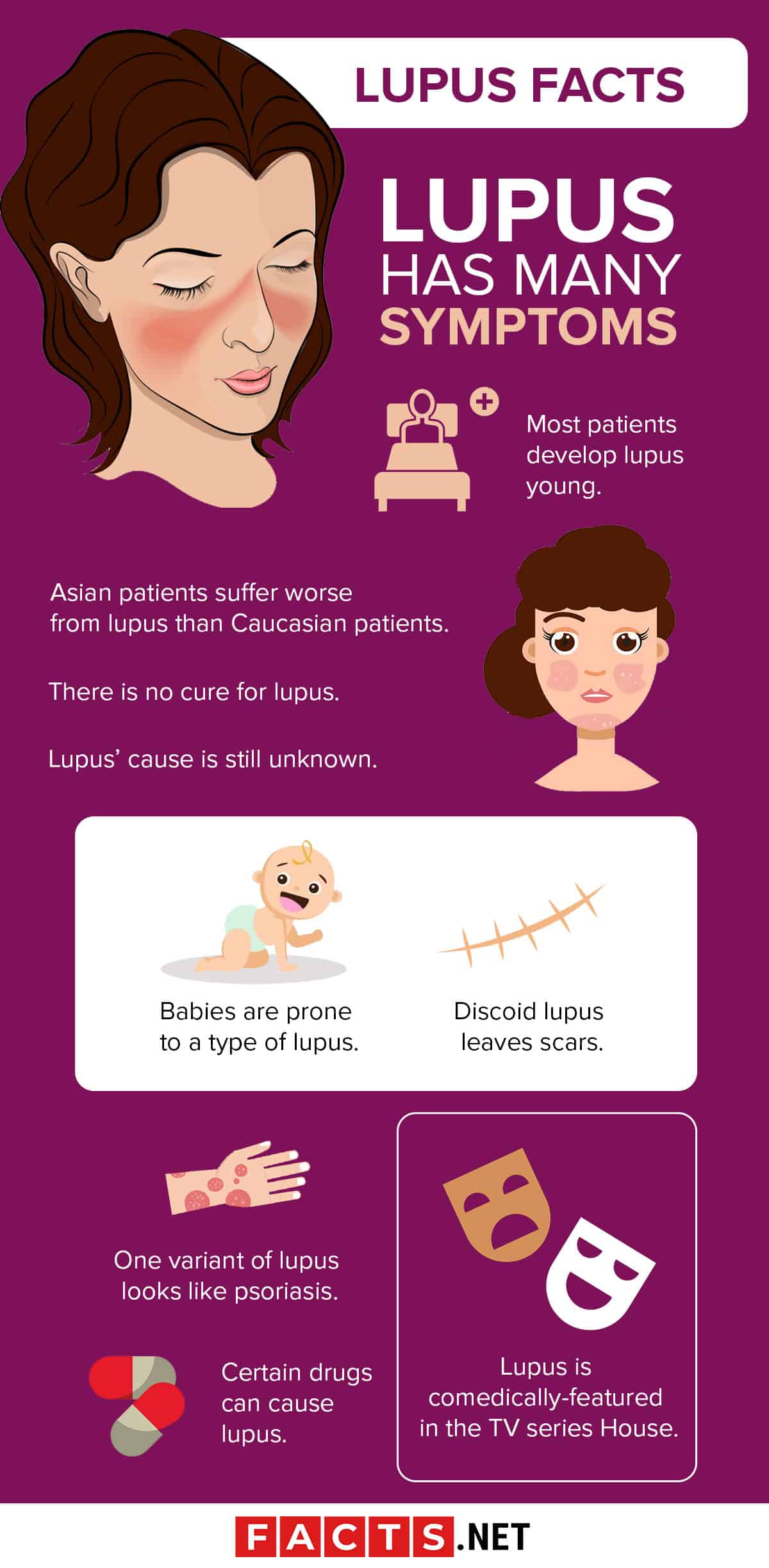 30 Facts About Lupus That You Really Should Know About 