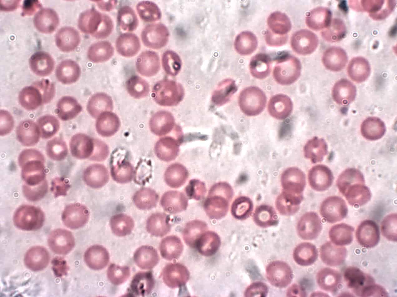 hemoglobin, sysnthetic biology facts