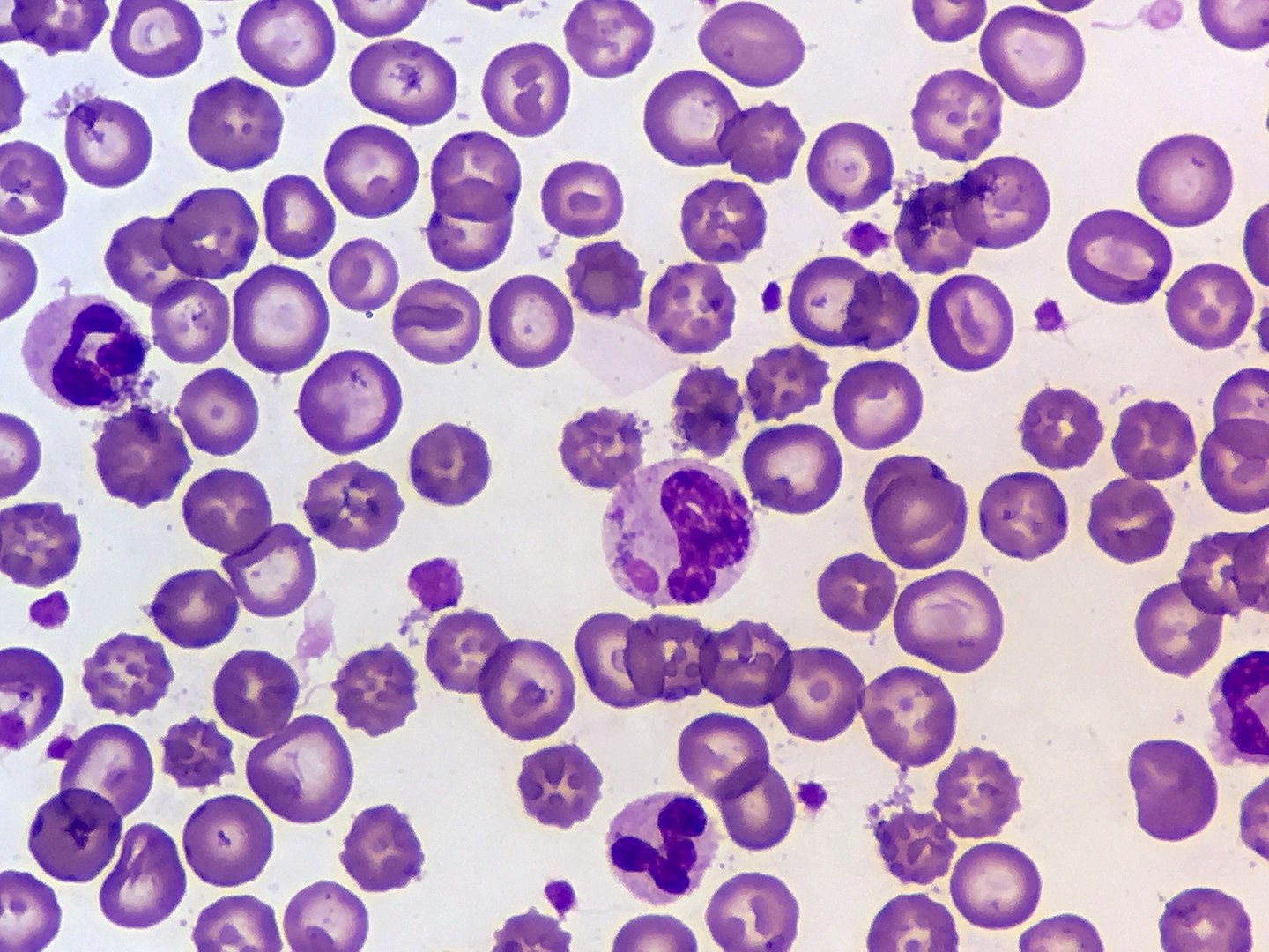 Pitbull Facts, Distemper-infected Blood