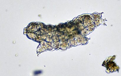 40 Tardigrade Facts About the Worlds Toughest Animal 