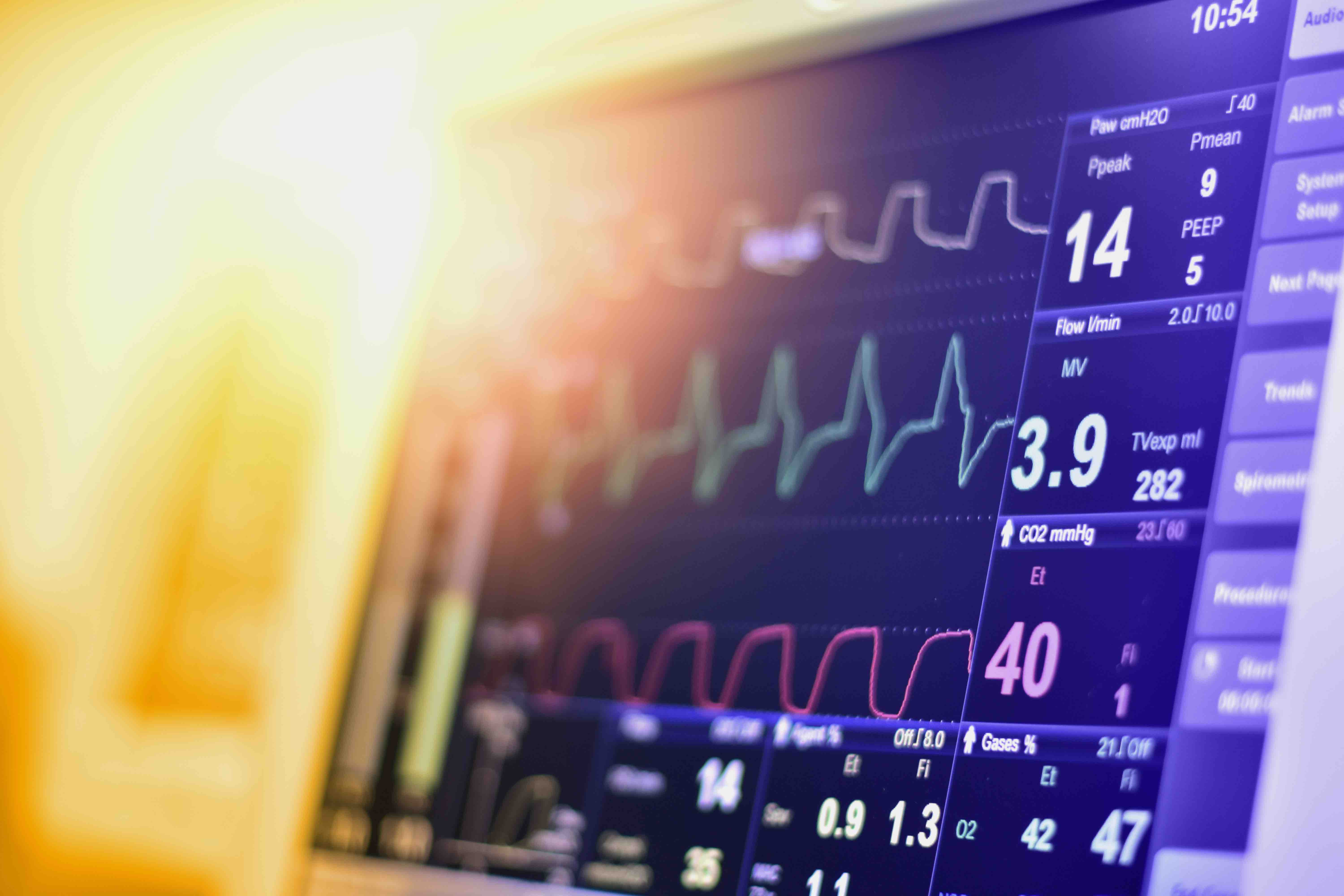 EKG monitor in intra aortic balloon pump machine in icu on blur background, Brain waves in electroencephalogram, heart rate wave