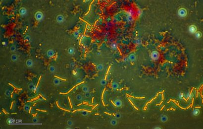 Eubacteria 19 Fun Facts About These Fascinating Microorganisms 