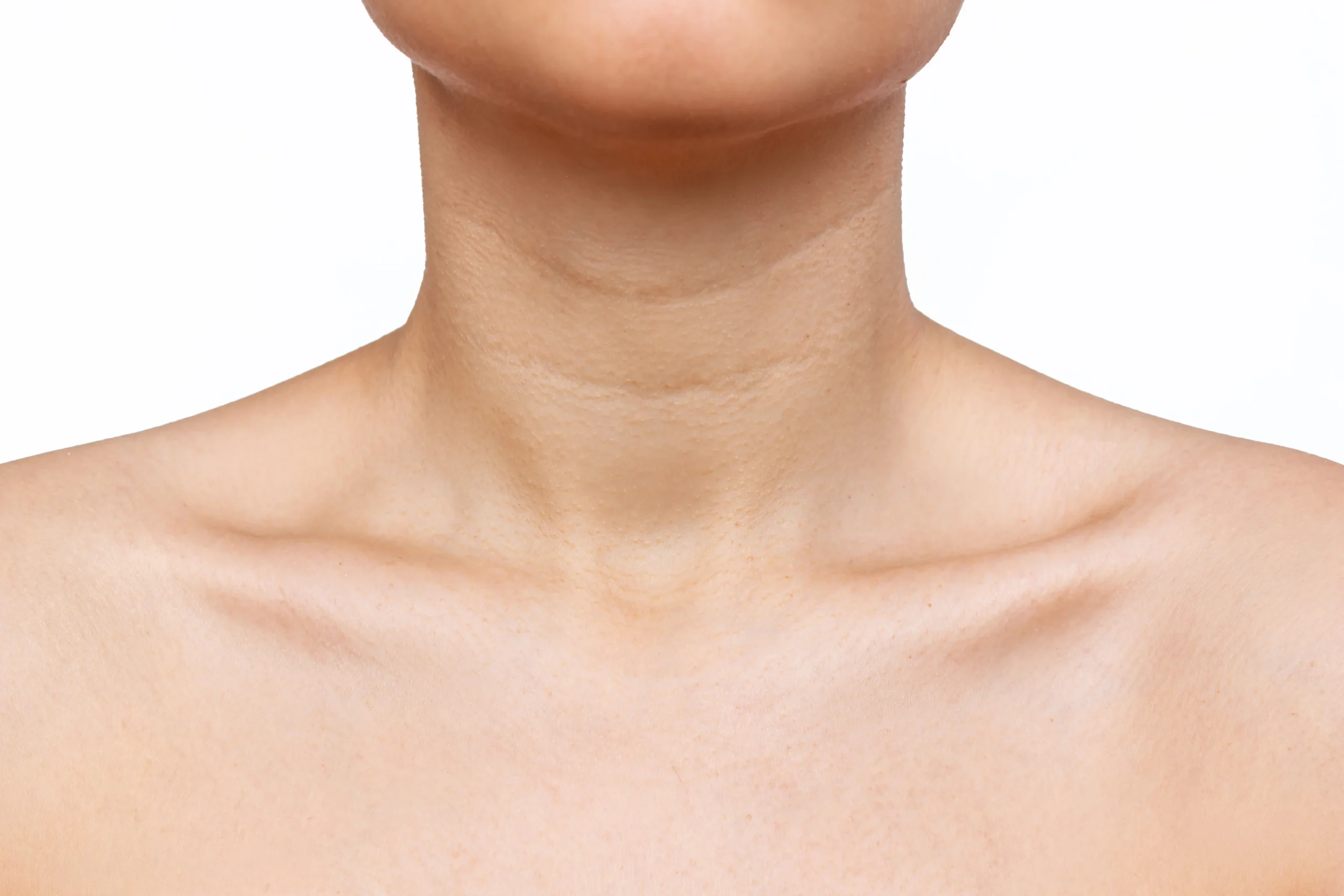 Front View Of The Neck And Upper Chest Of A Woman Photograph by Phil  Jude/science Photo Library - Fine Art America
