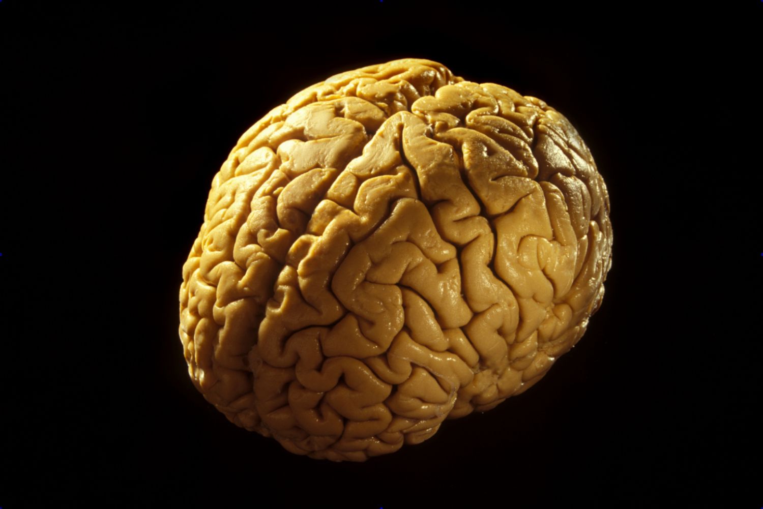 11-fascinating-facts-about-cerebrum