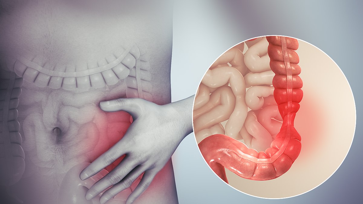 12-unbelievable-facts-about-transverse-colon