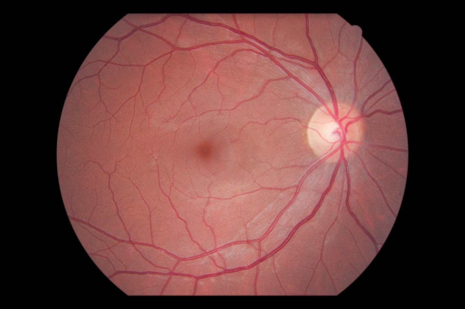 13-astonishing-facts-about-optic-nerve