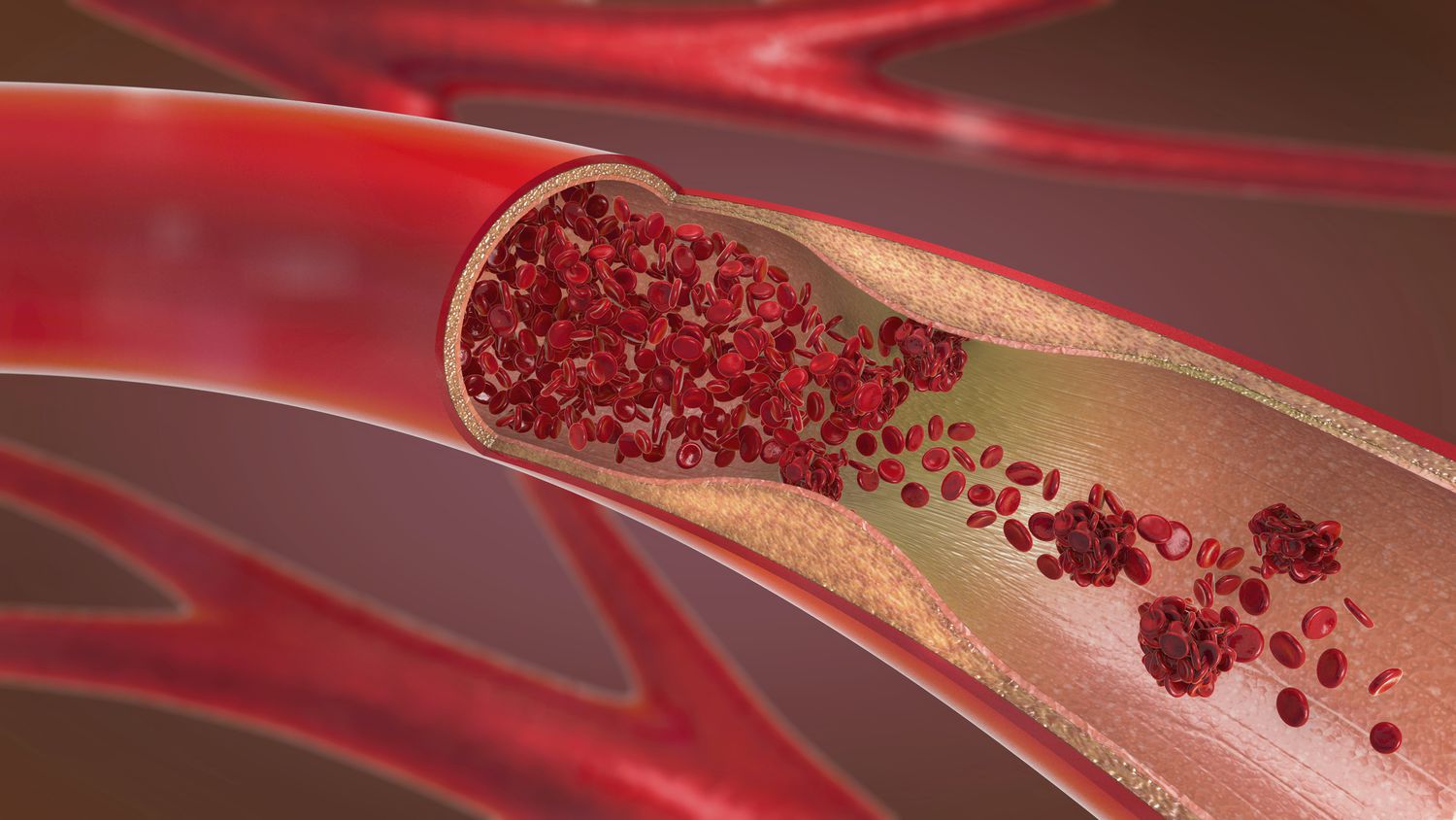 14-astounding-facts-about-arteries