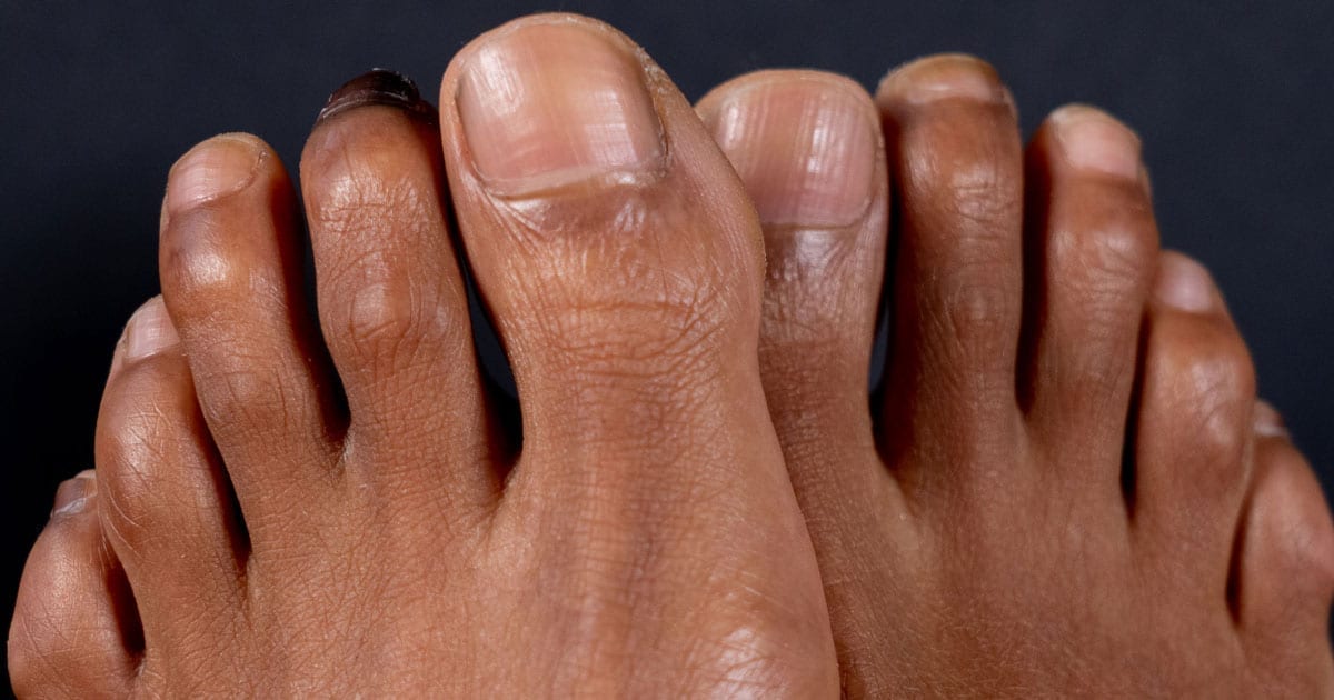 15-fascinating-facts-about-toes