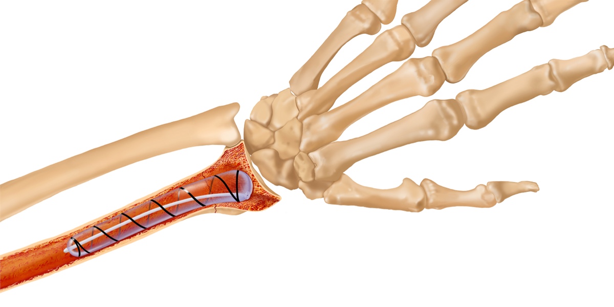 16-astounding-facts-about-ulna