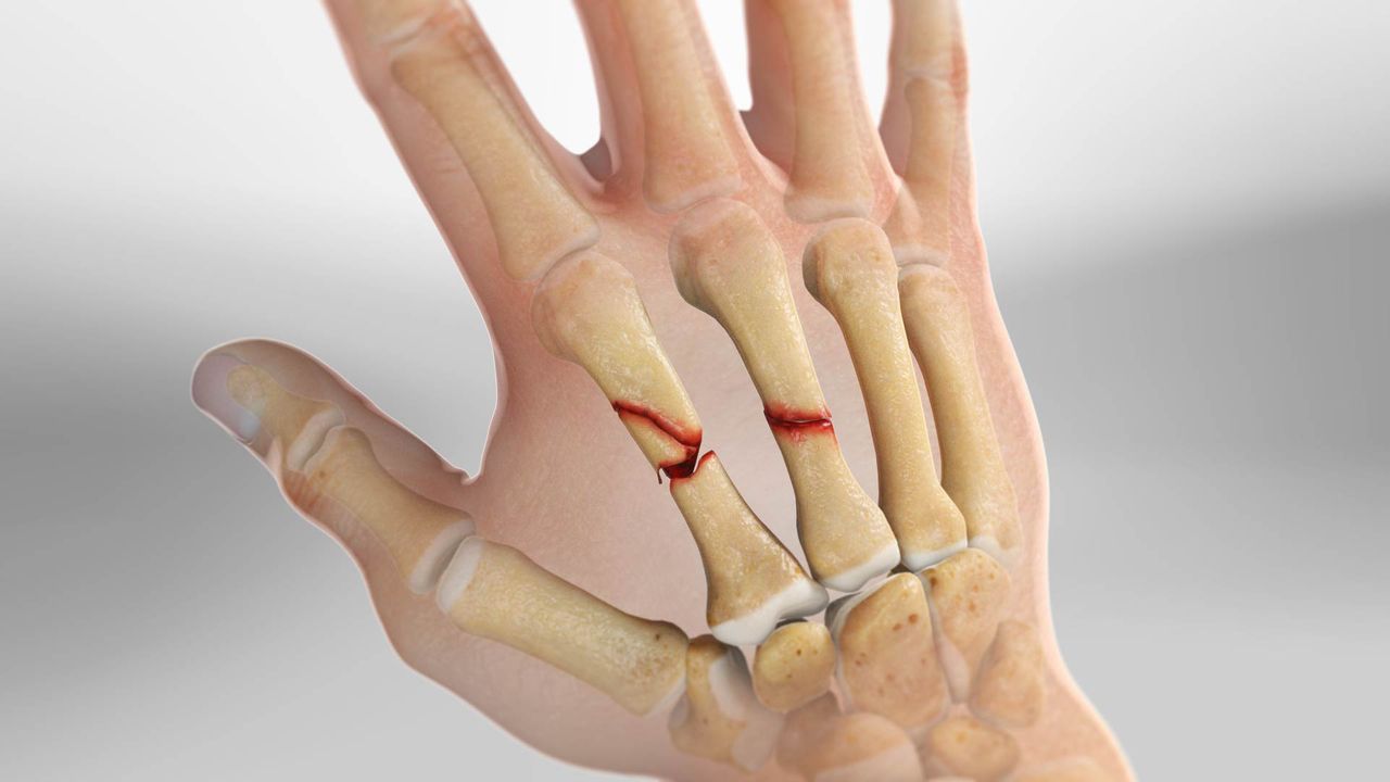 19-enigmatic-facts-about-metacarpal-bones