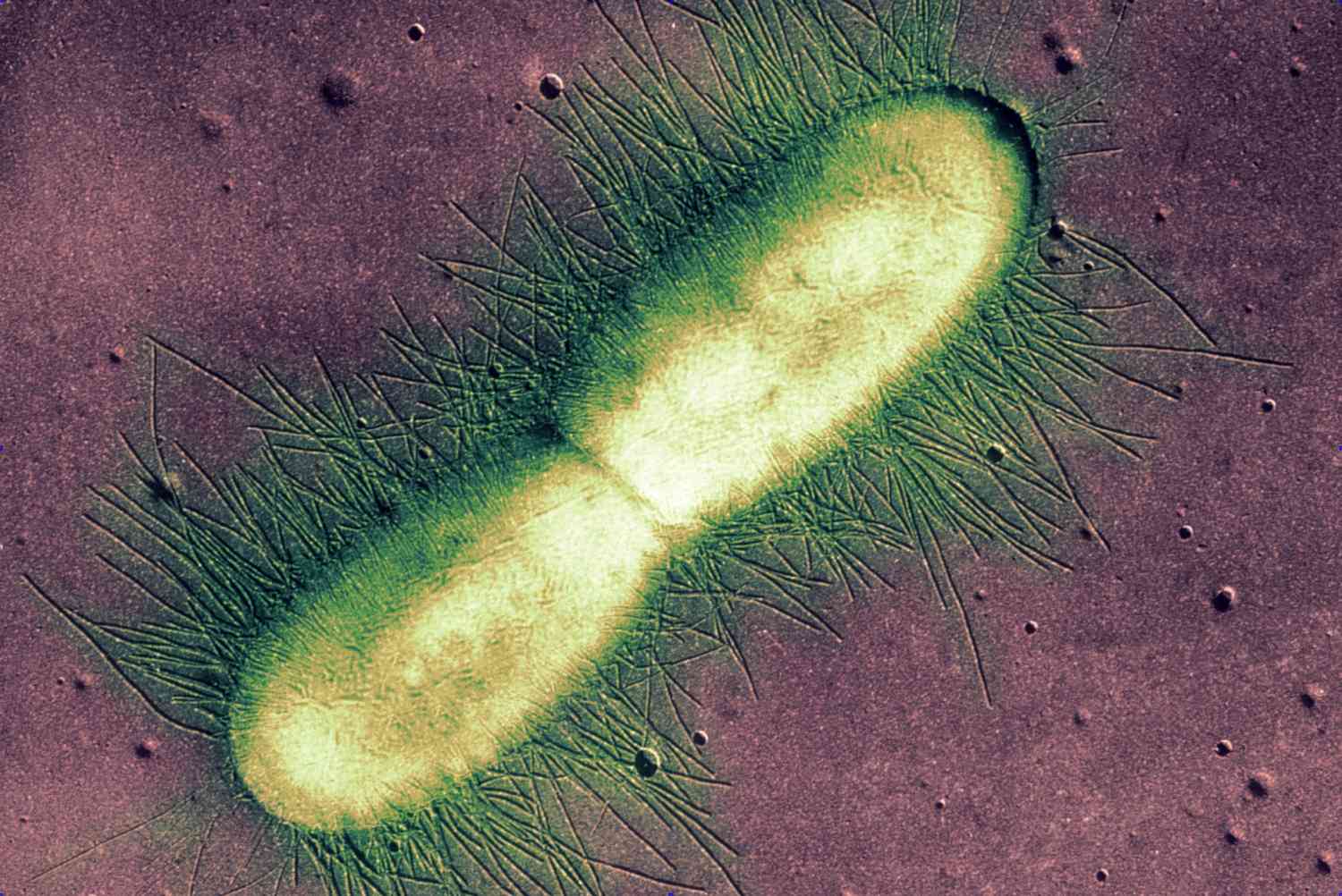 14-astounding-facts-about-prokaryote