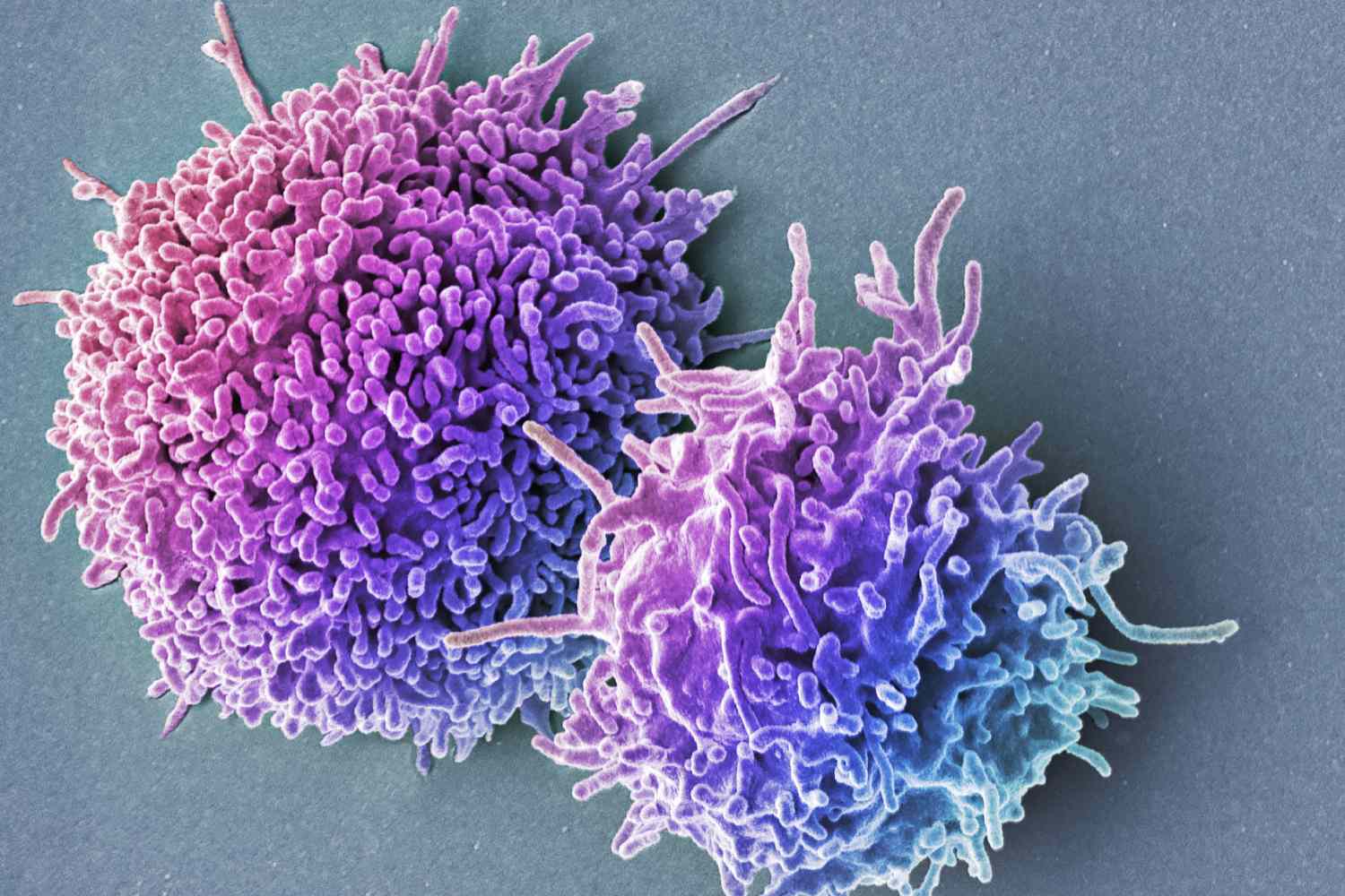 18-unbelievable-facts-about-t-lymphocytes