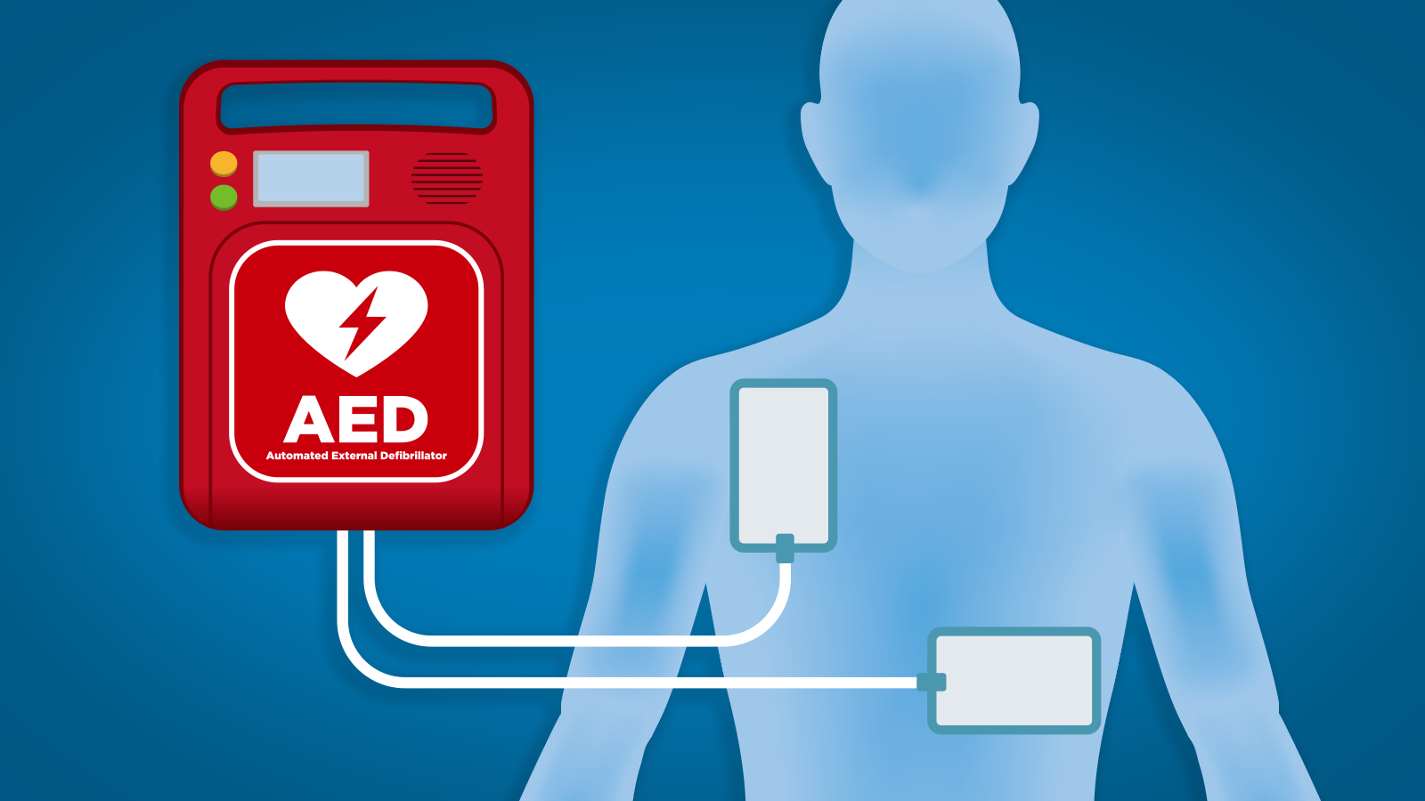 10-aed-devices-facts