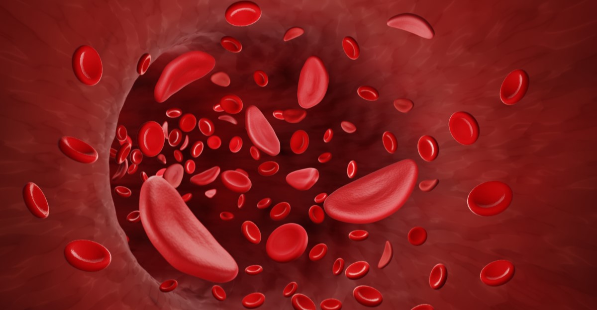 10-facts-about-sickle-cell