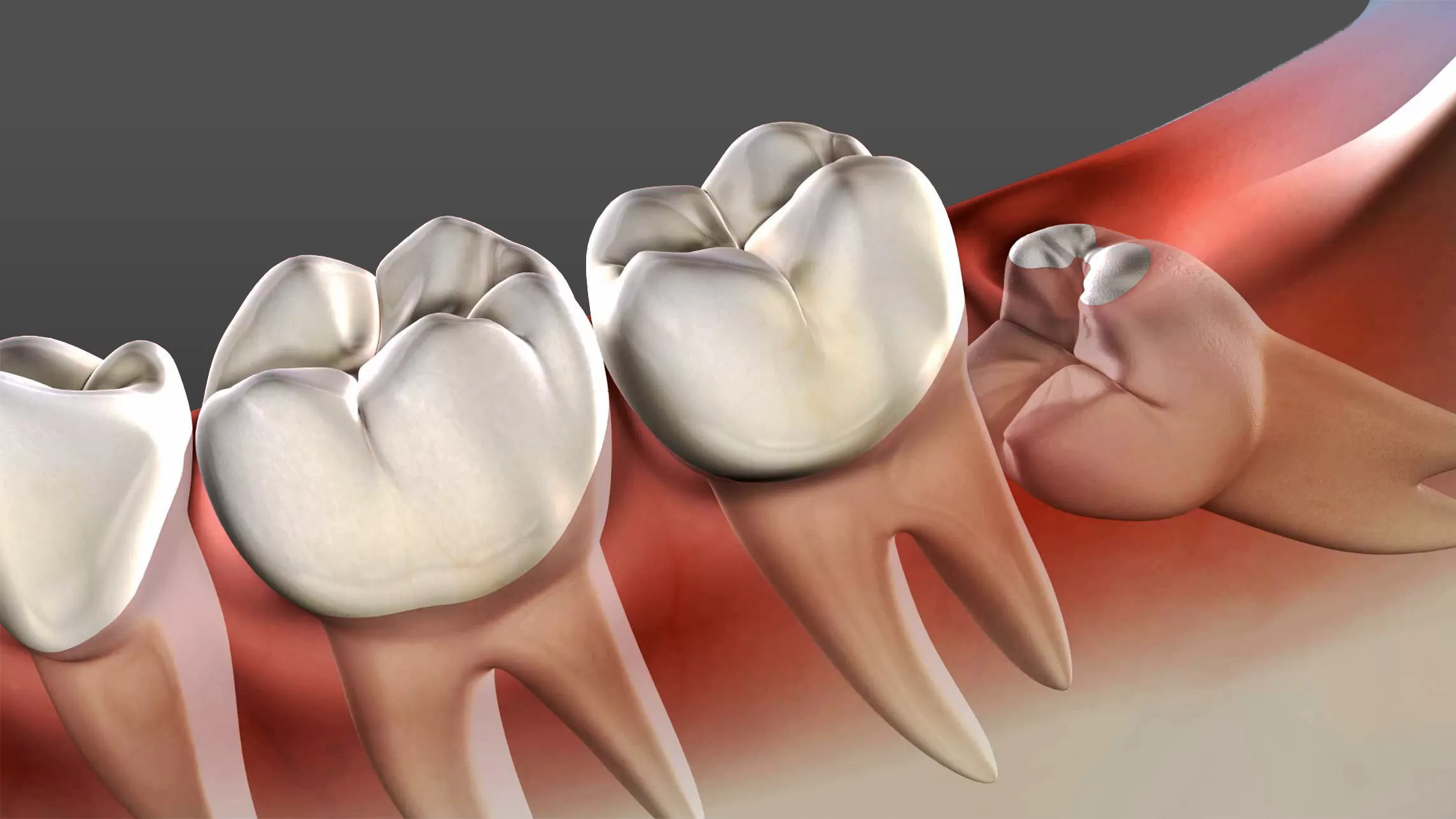 10-facts-about-wisdom-teeth