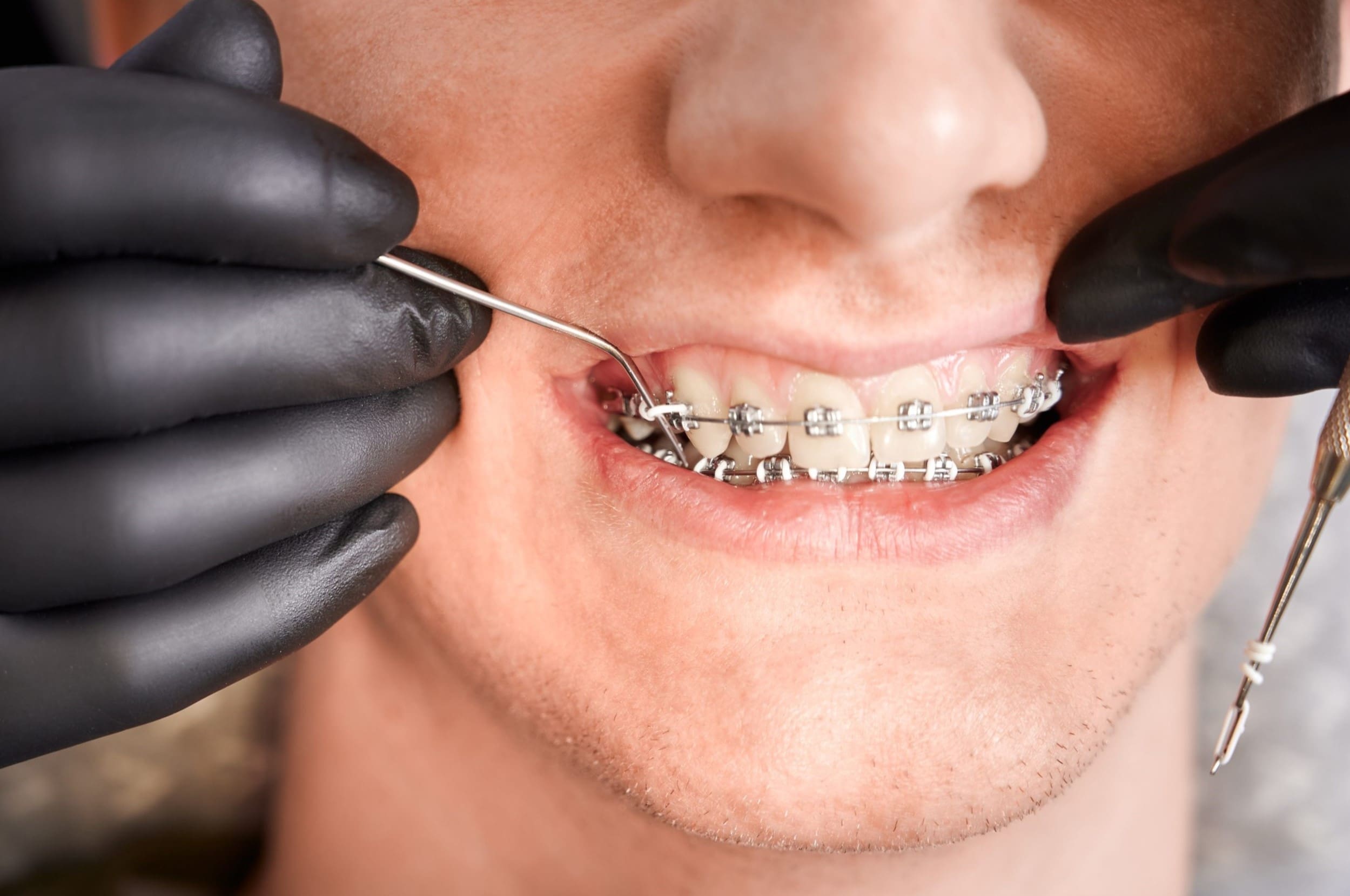 11-fun-facts-about-orthodontics