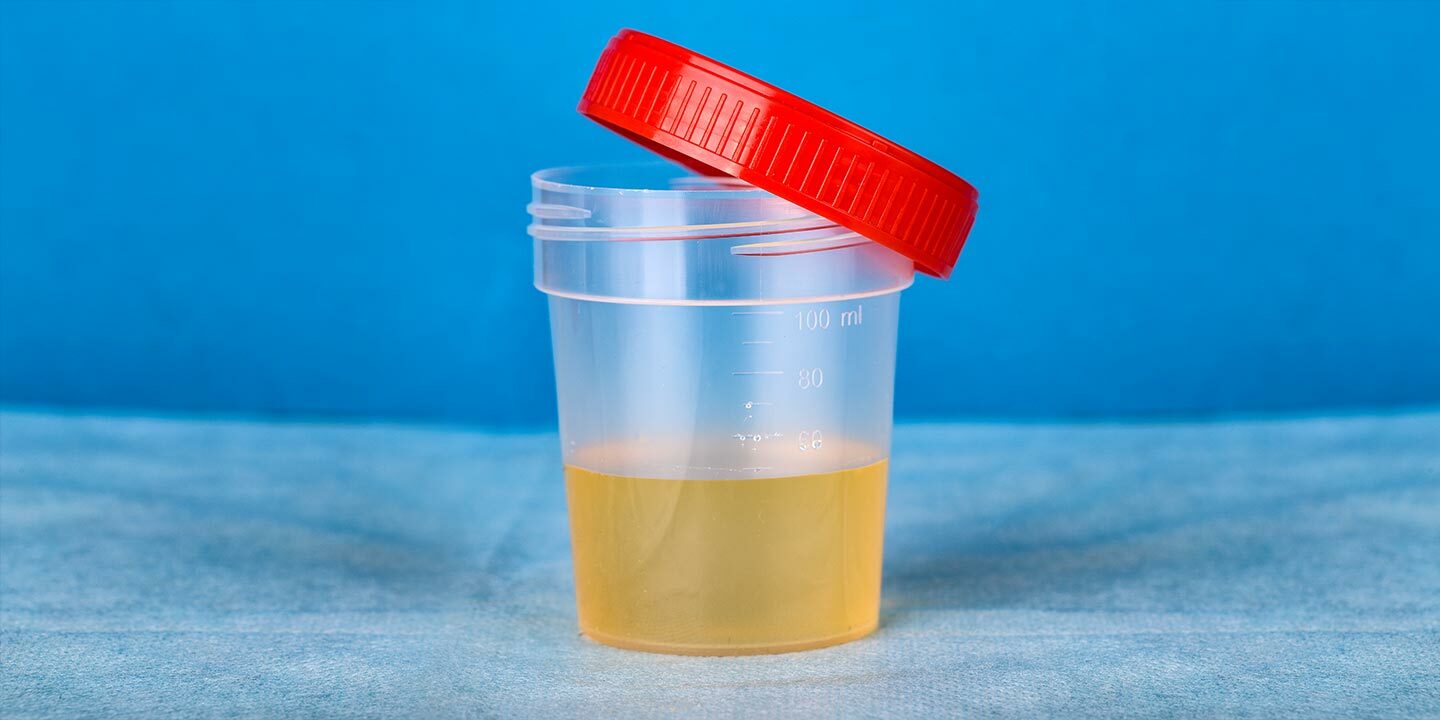 15-fun-facts-about-urine