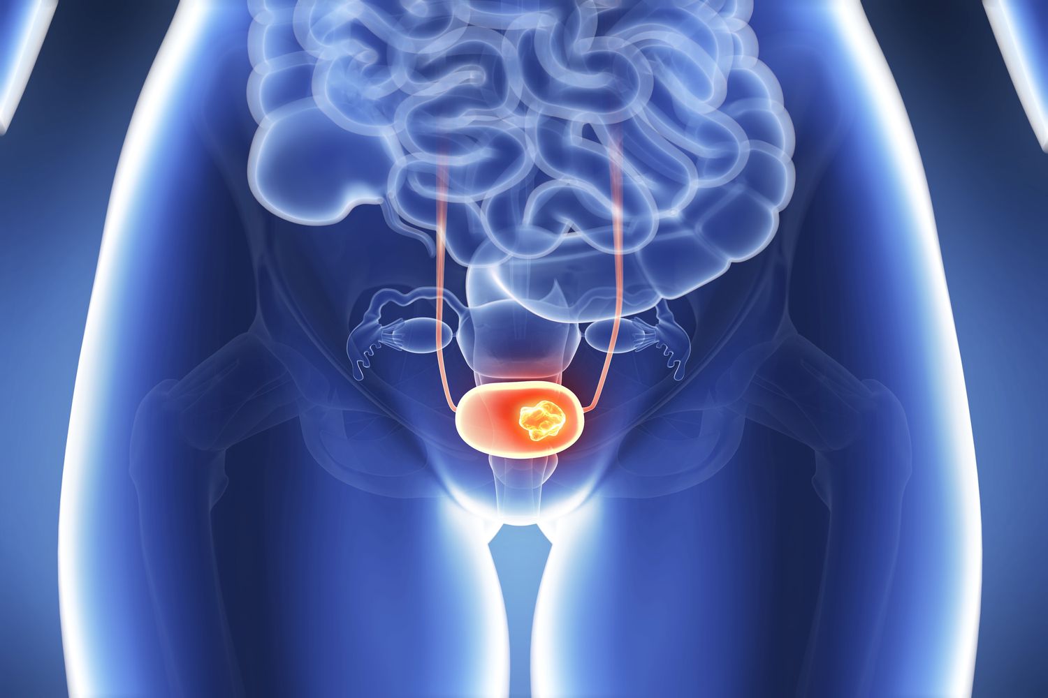 15-interesting-facts-about-bladder-cancer