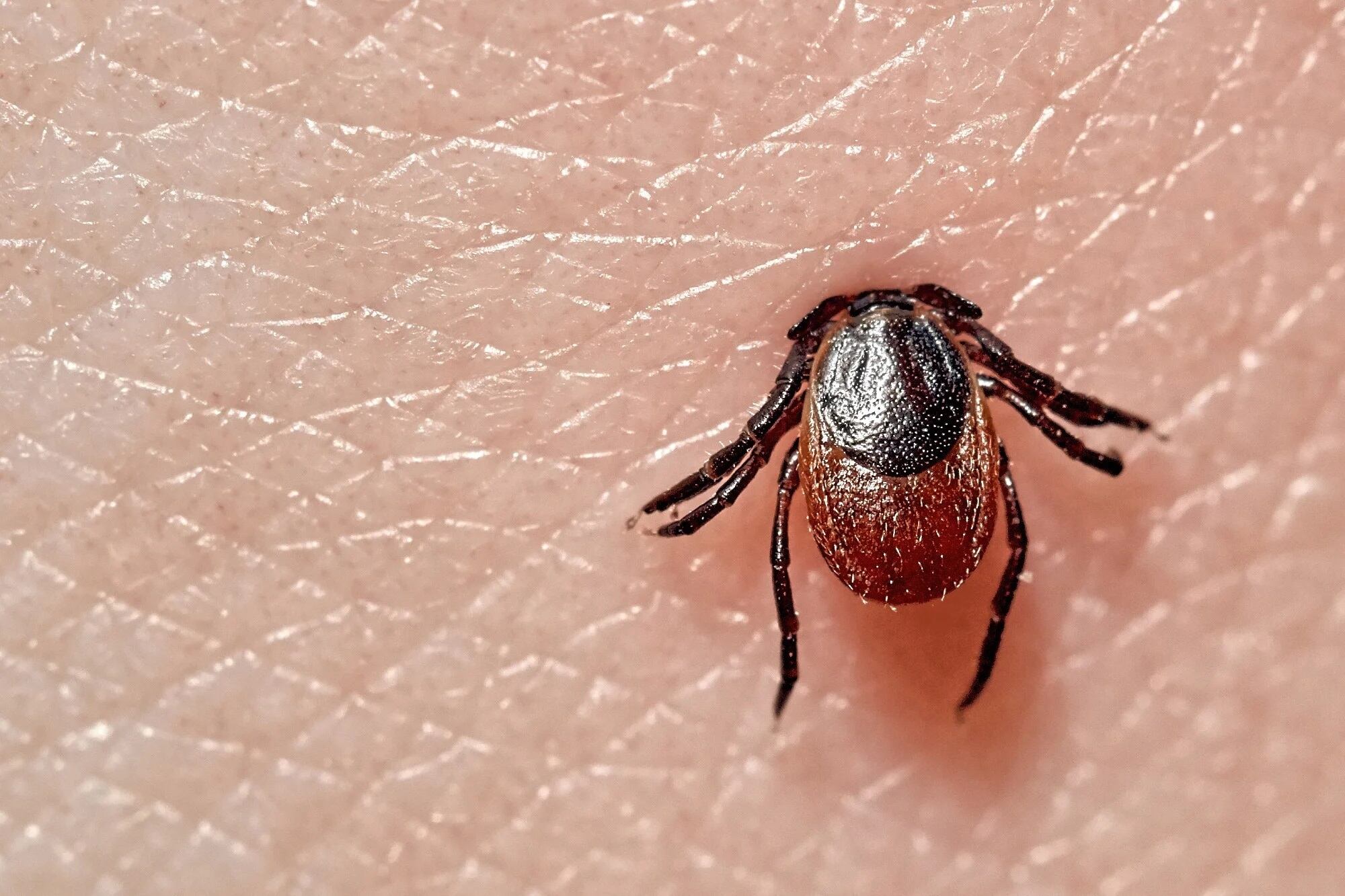 18-fun-facts-about-lyme-disease