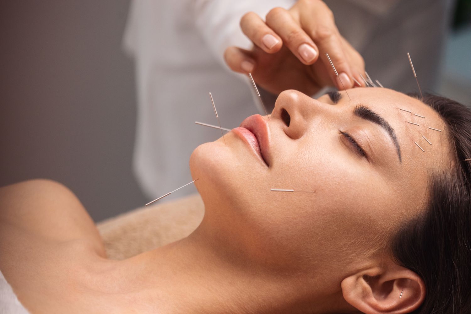 19-acupuncture-fun-facts