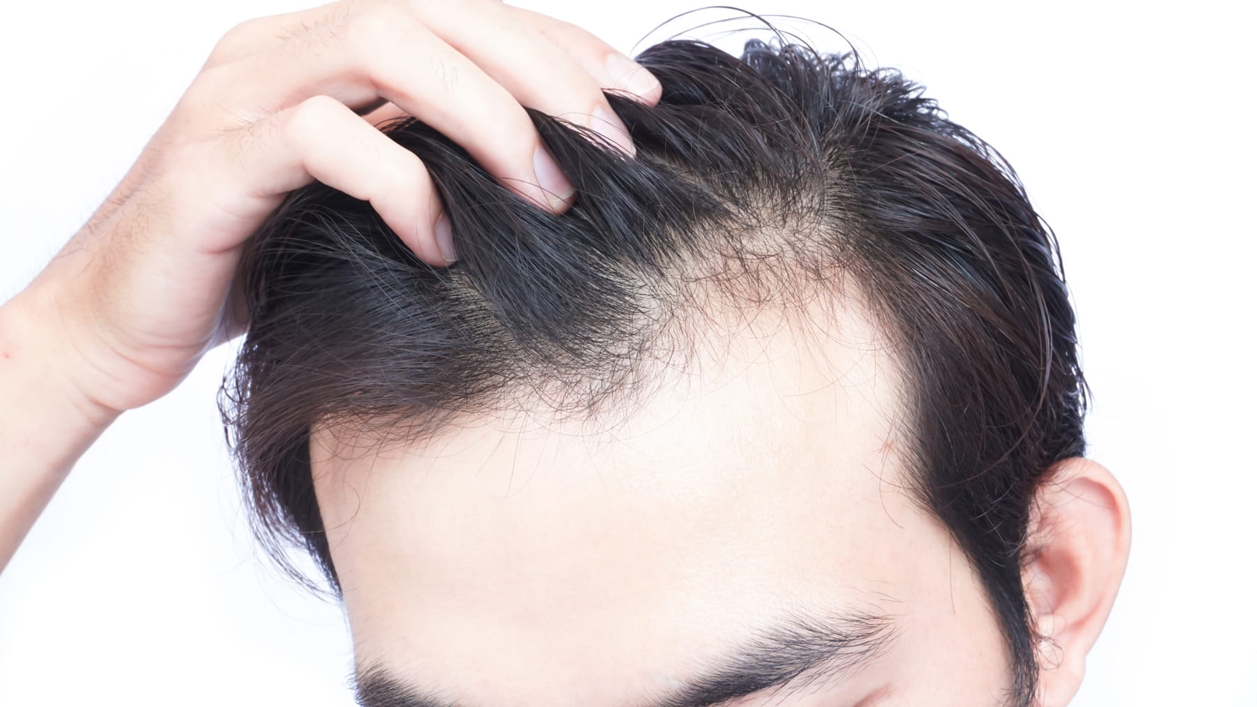 19-facts-about-hair-loss