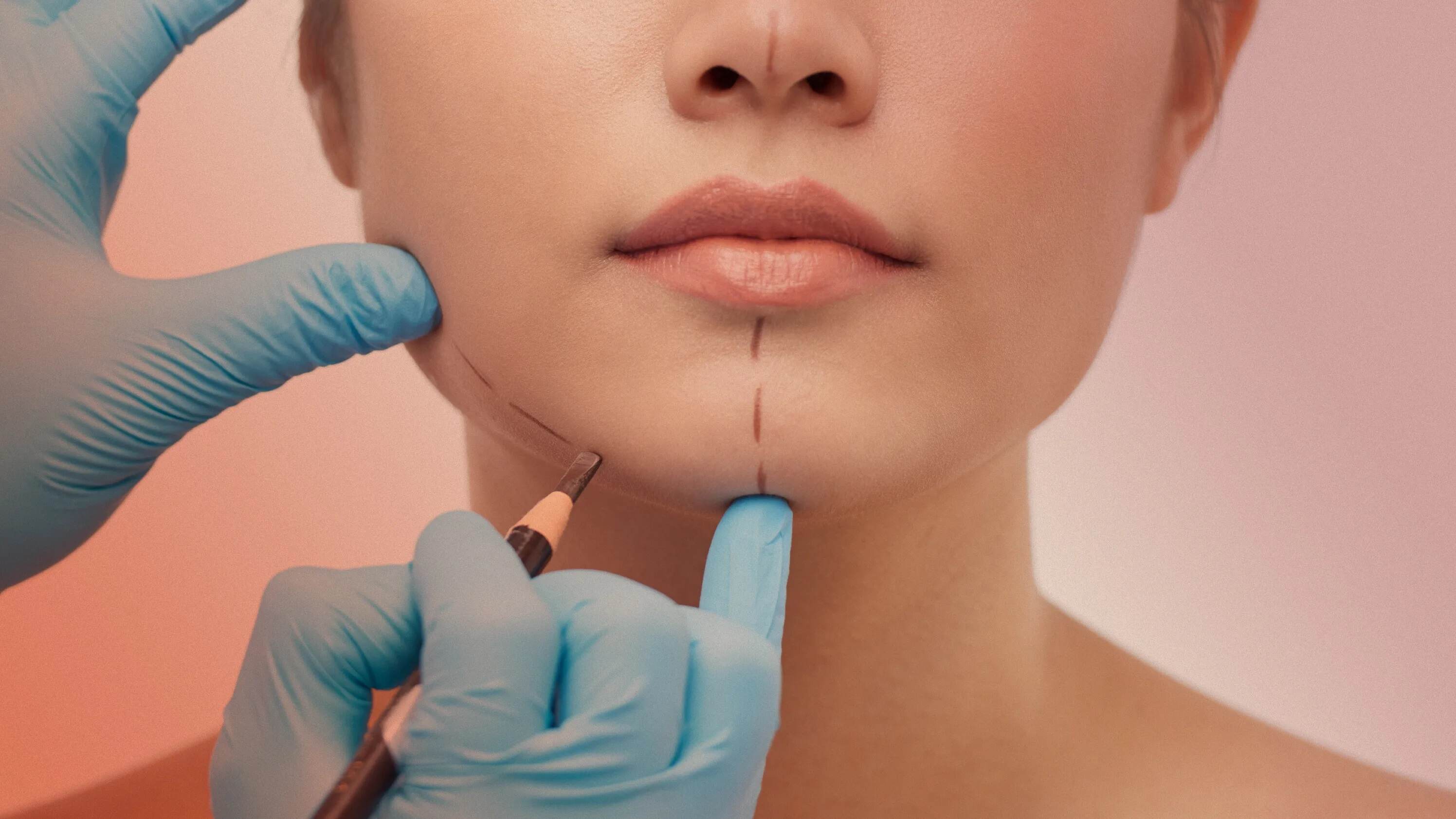 19-plastic-surgery-facts