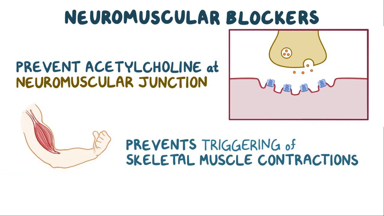 12-facts-you-must-know-about-neuromuscular-blockers