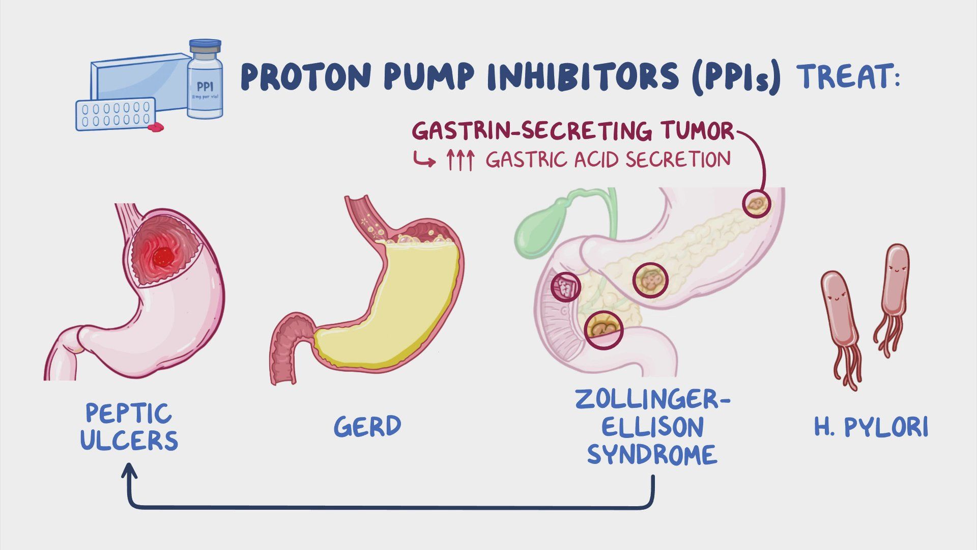12-facts-you-must-know-about-proton-pump-inhibitors