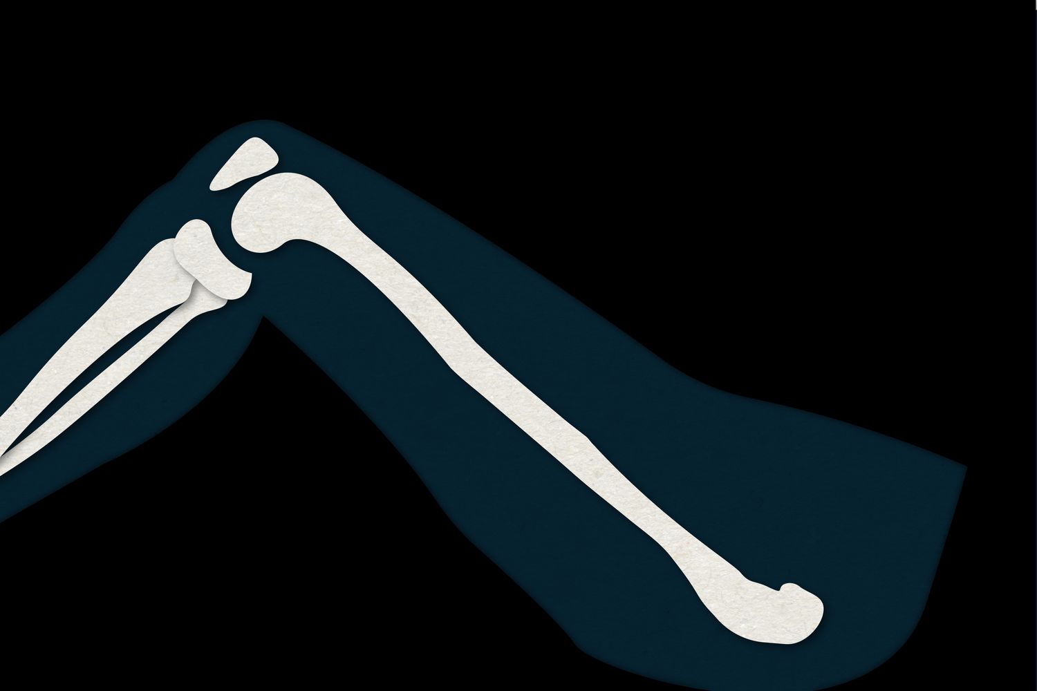 19-fun-facts-about-the-femur