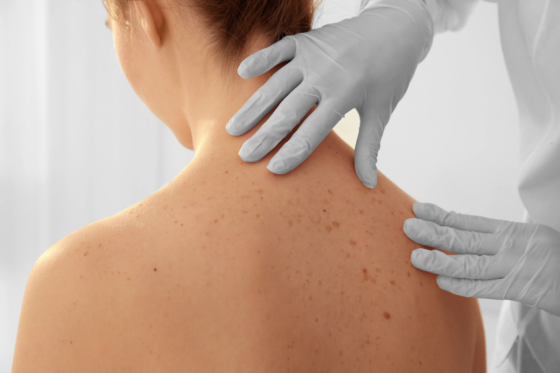 11 Facts About Skin Cancer Awareness Month May 