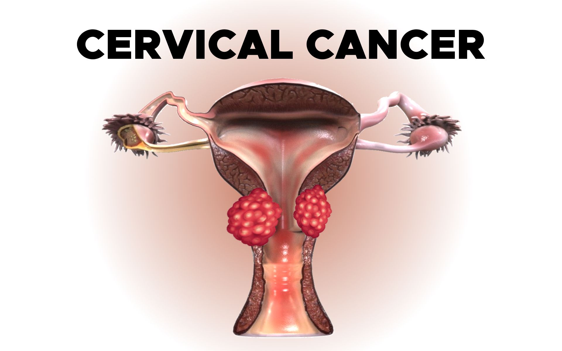 14-facts-about-cervical-cancer