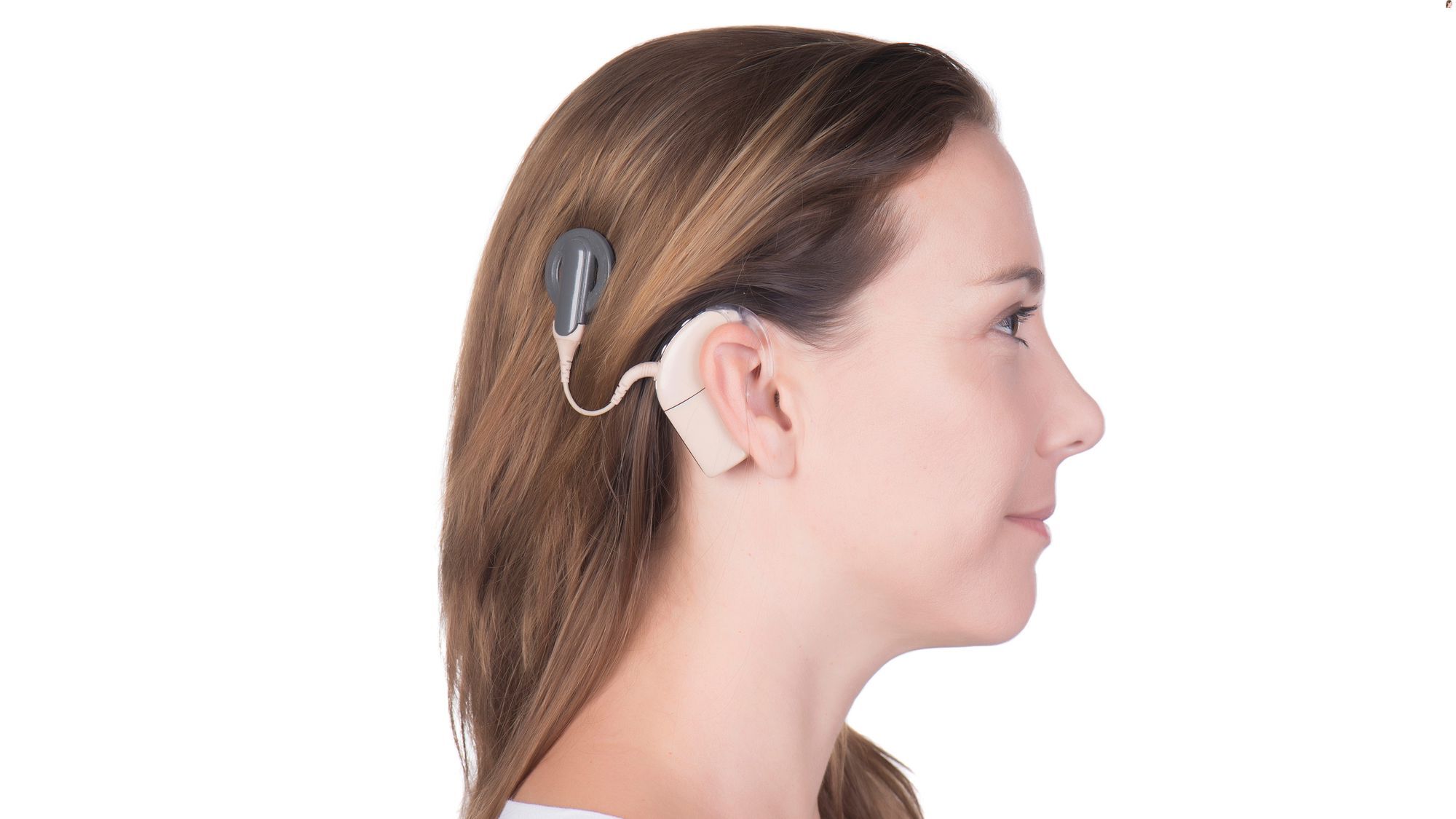 16 Best Cochlear Implant Facts - Facts.net