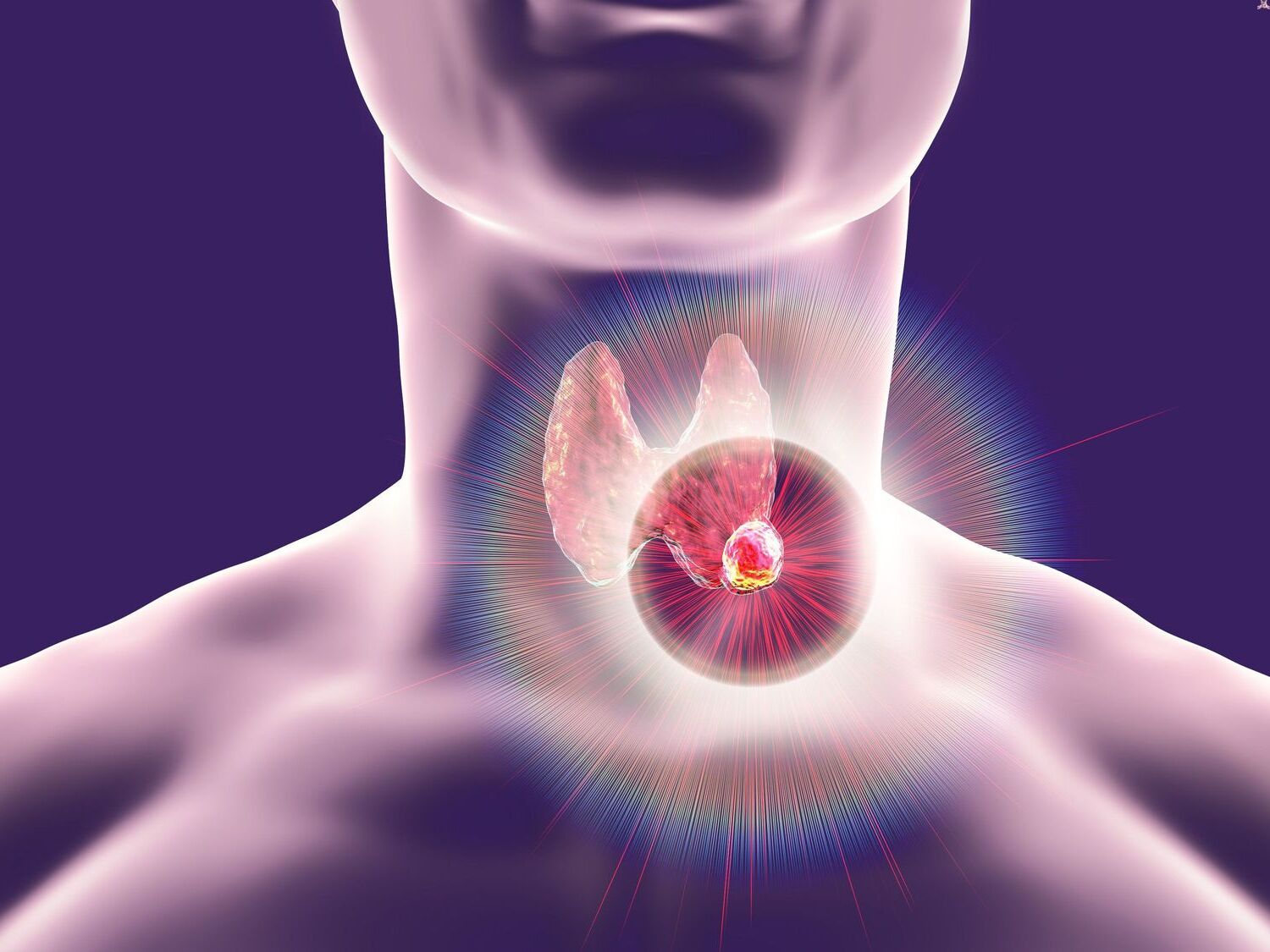 20-best-facts-about-thyroid-cancer