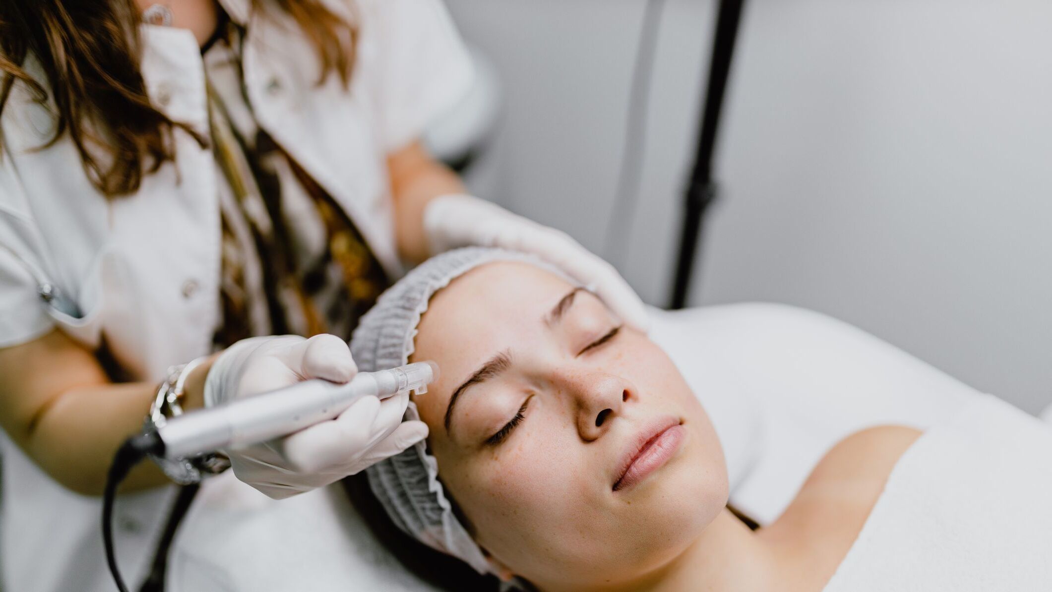 20-facts-about-bio-microneedling