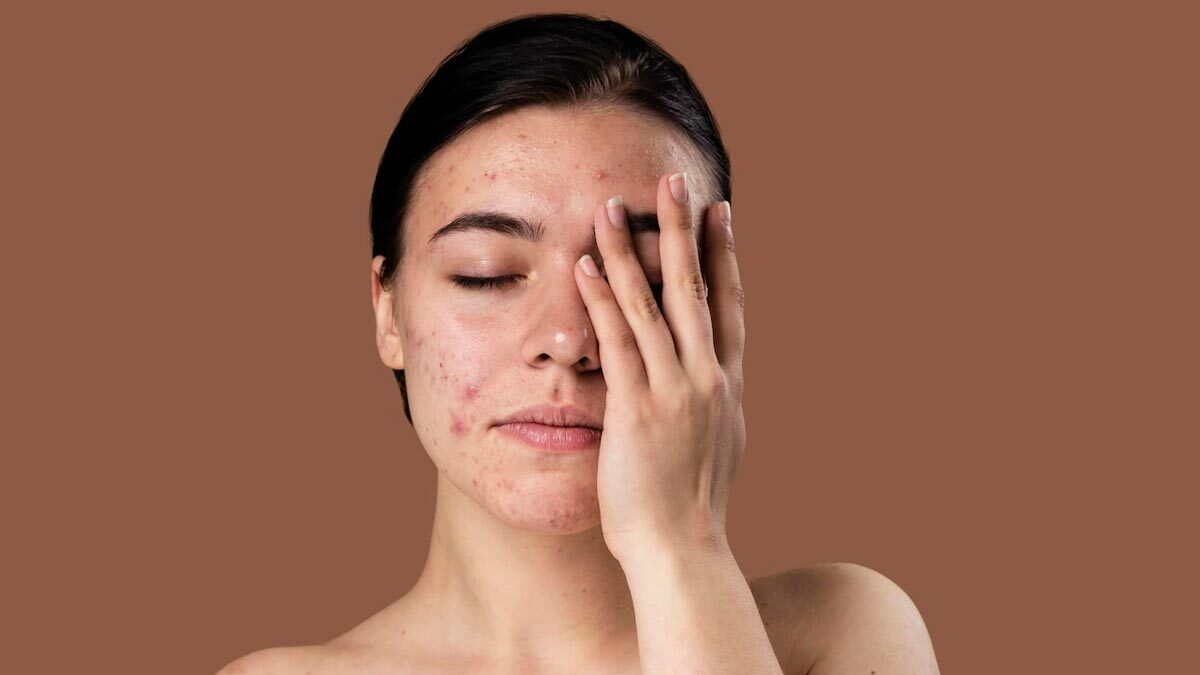 20-facts-about-sensitive-skin