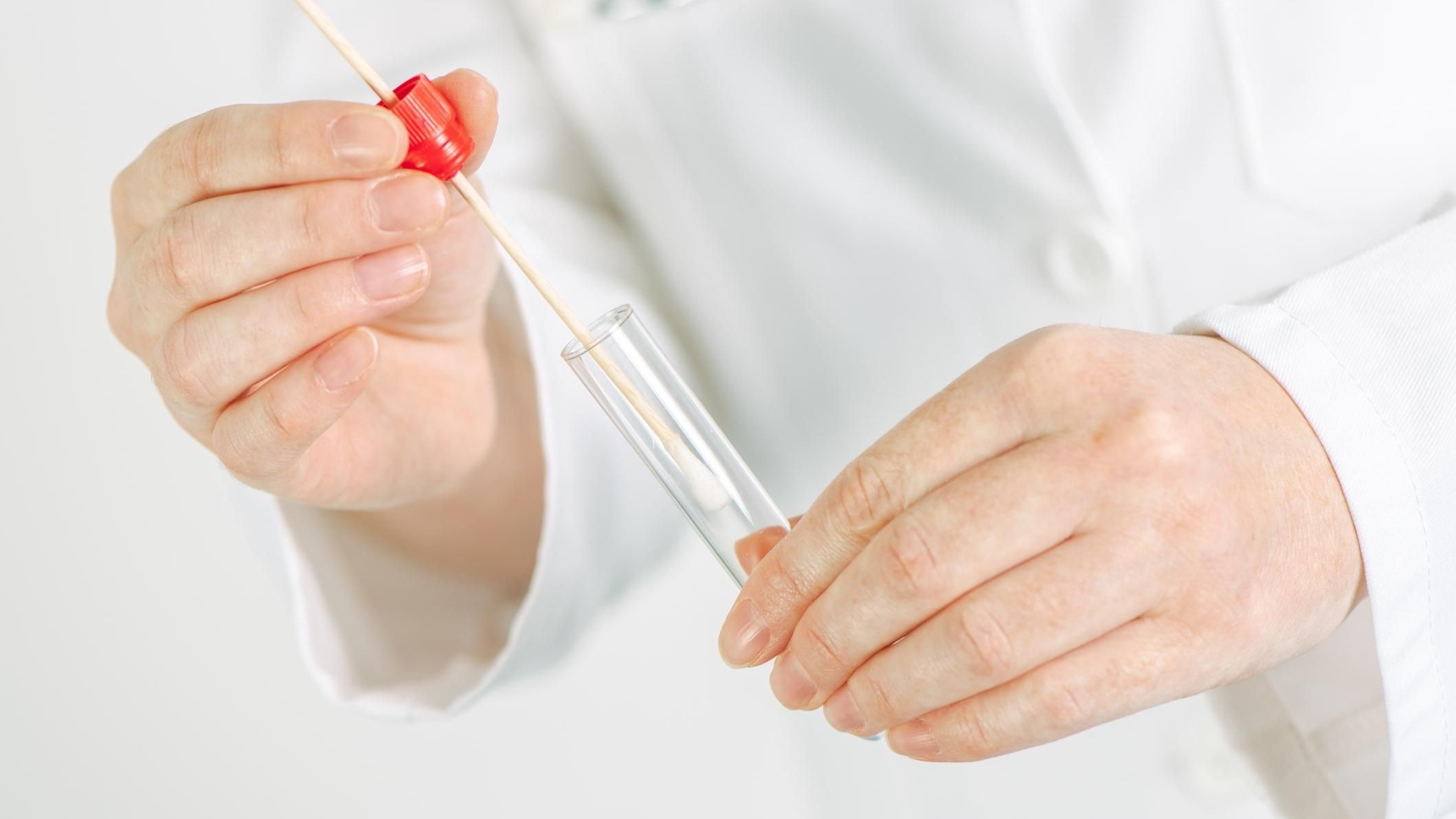 15-facts-about-mycoplasma-genitalium-testing