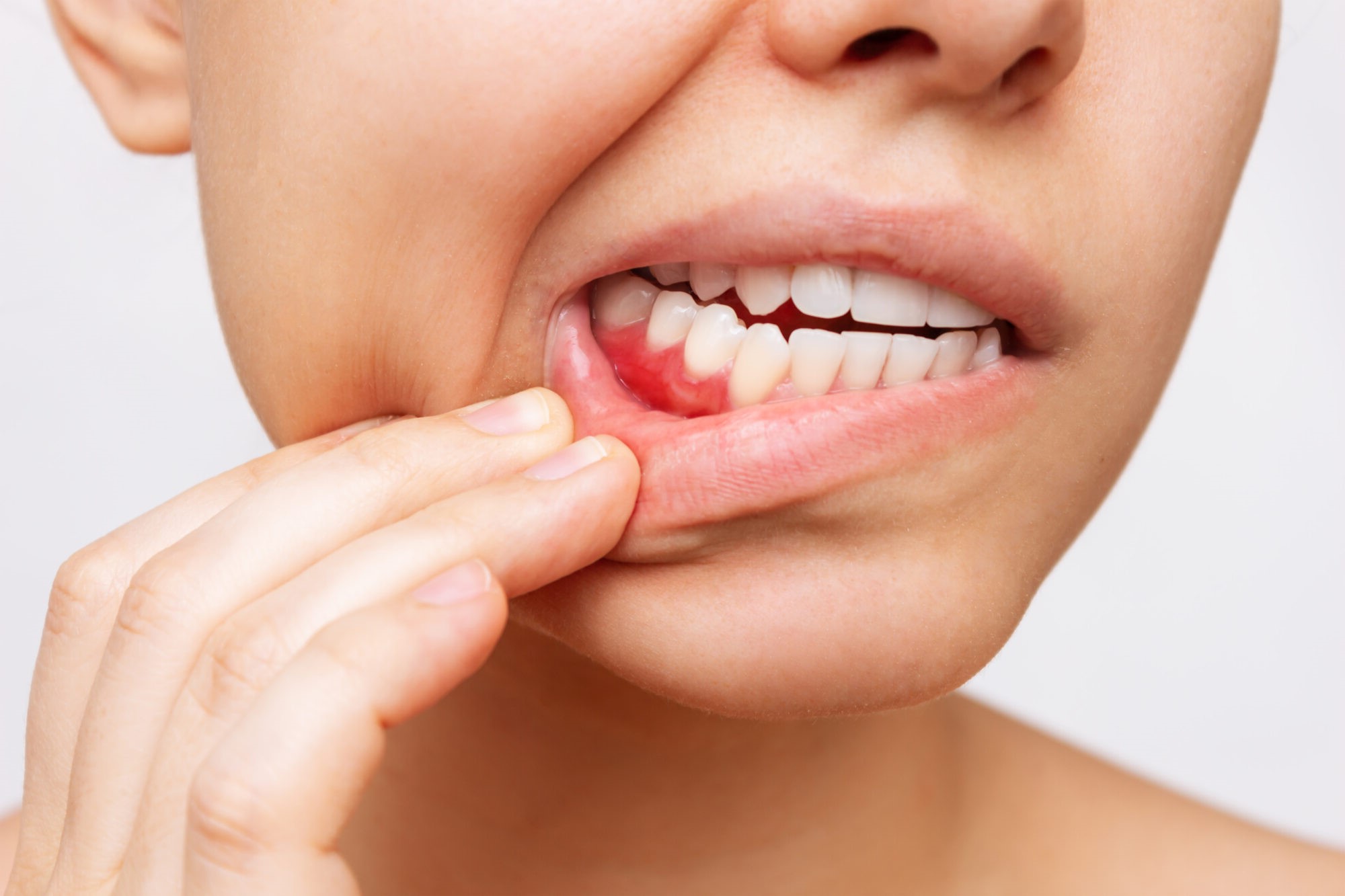 18-facts-about-gum-disease