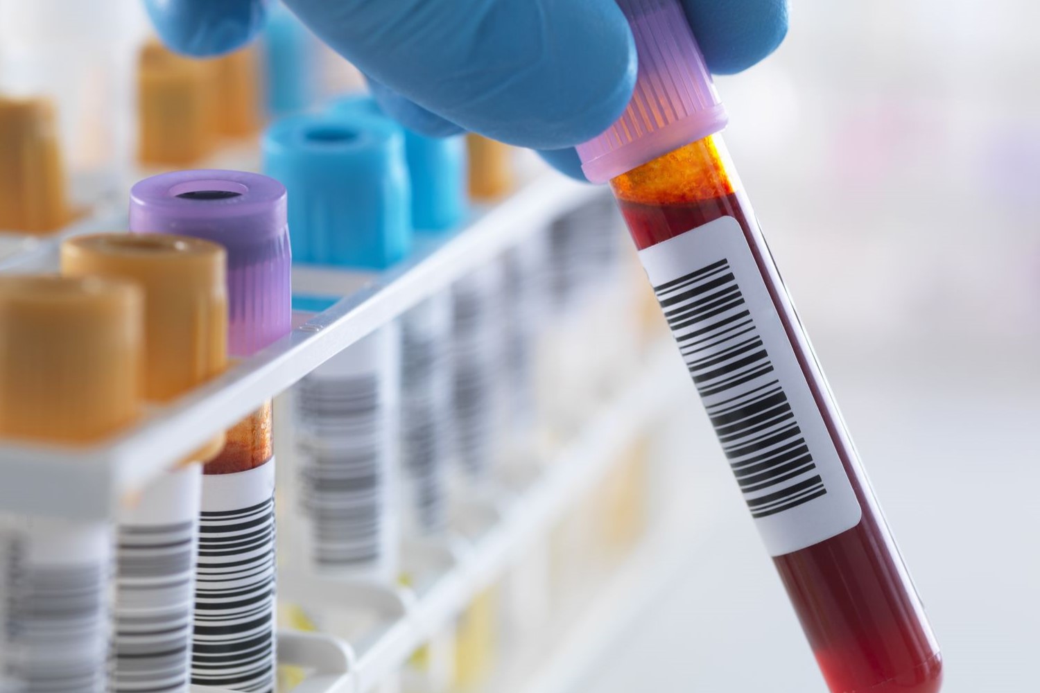 20-facts-about-blood-drug-test
