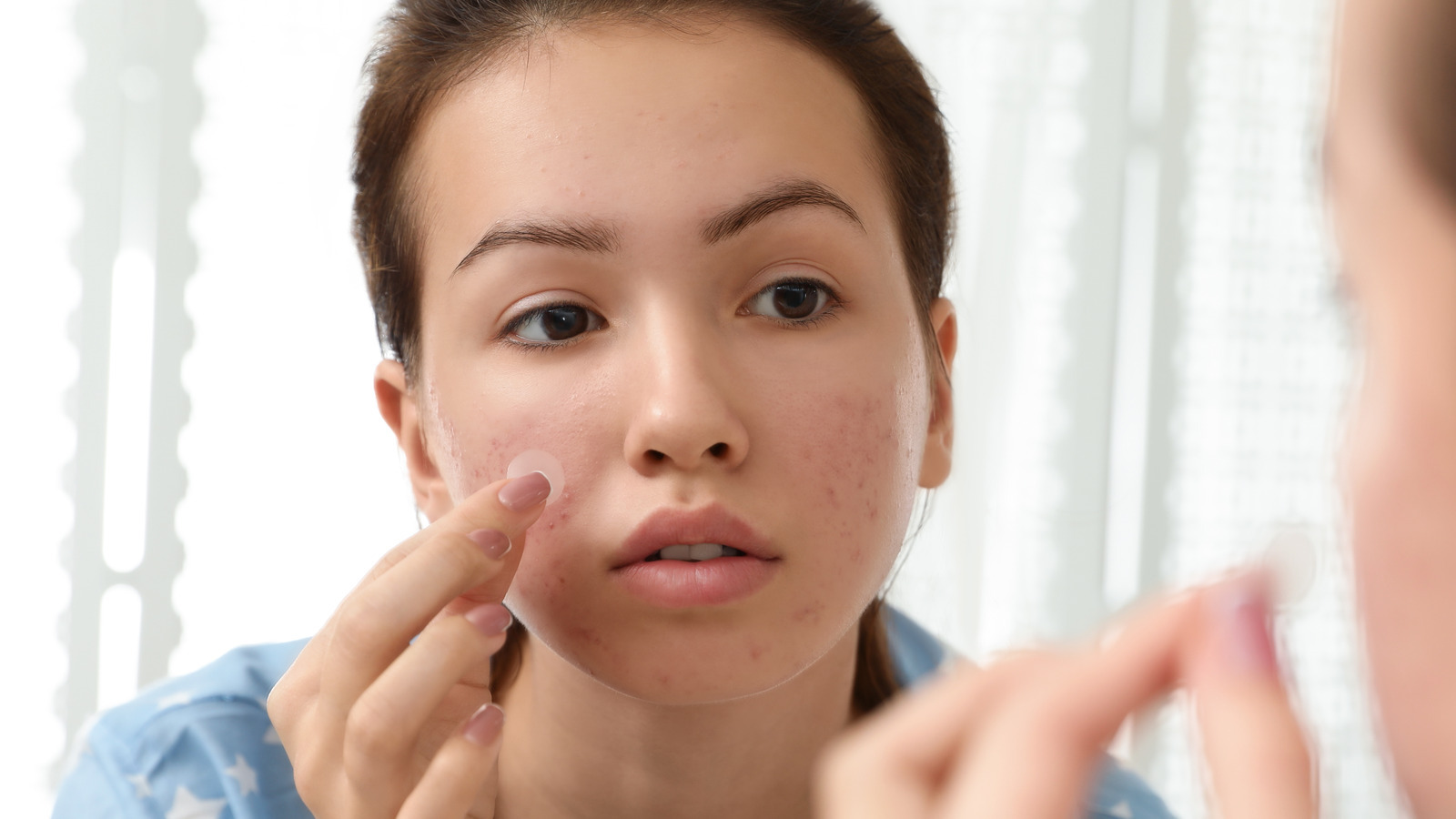 20-facts-about-pimple-patches