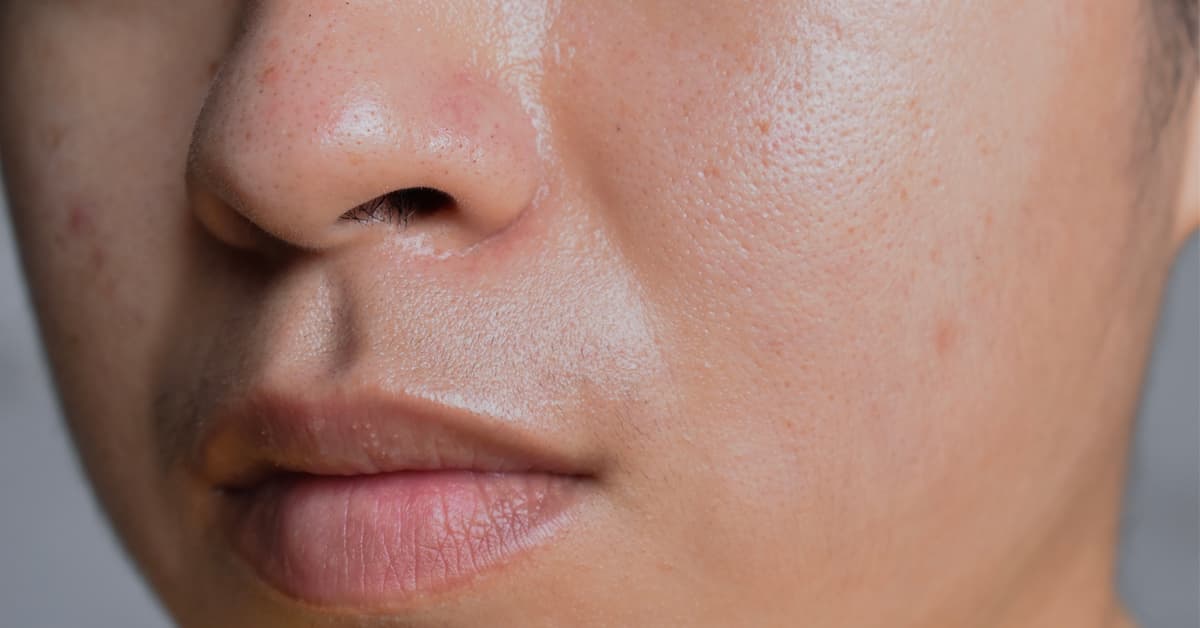40-facts-about-oily-skin