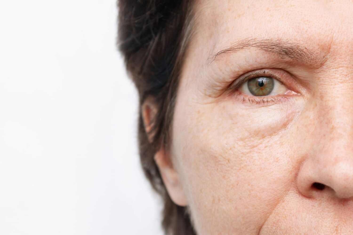 40-facts-about-puffy-eyes