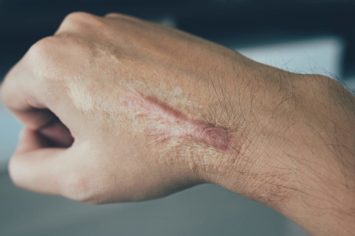 40-facts-about-scars