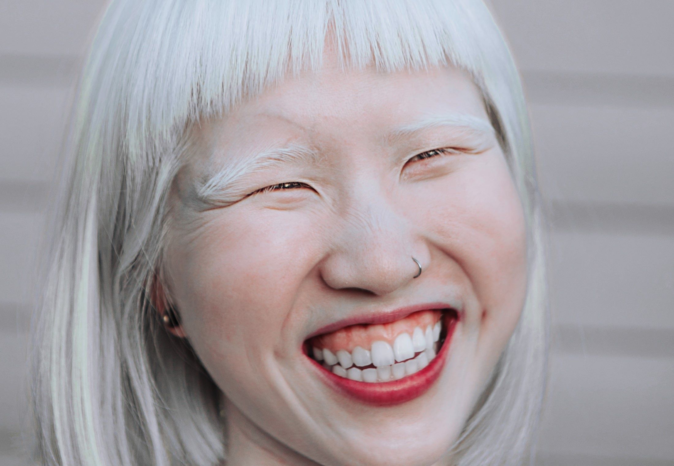 50-facts-about-albinism
