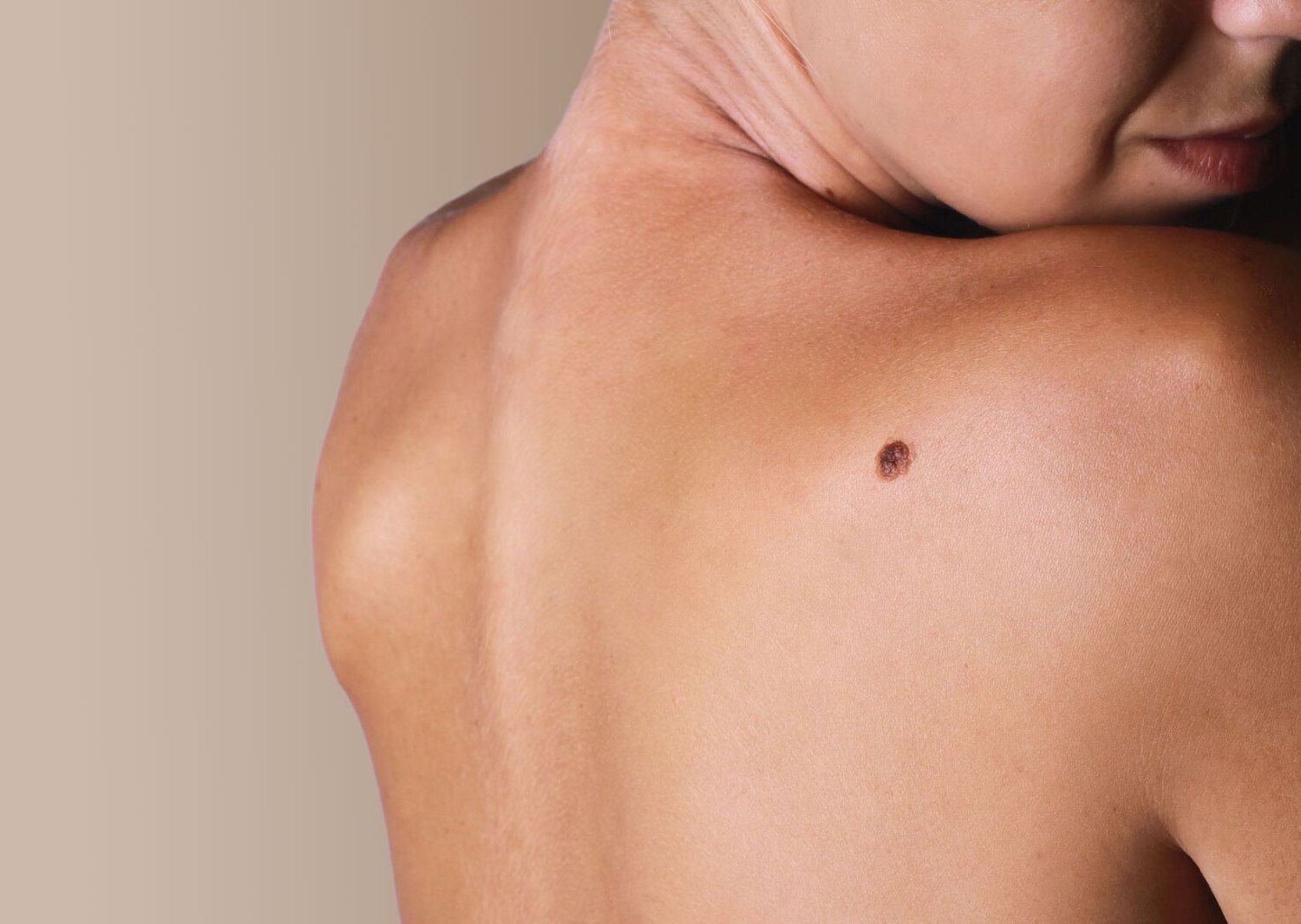 50-facts-about-moles-skin