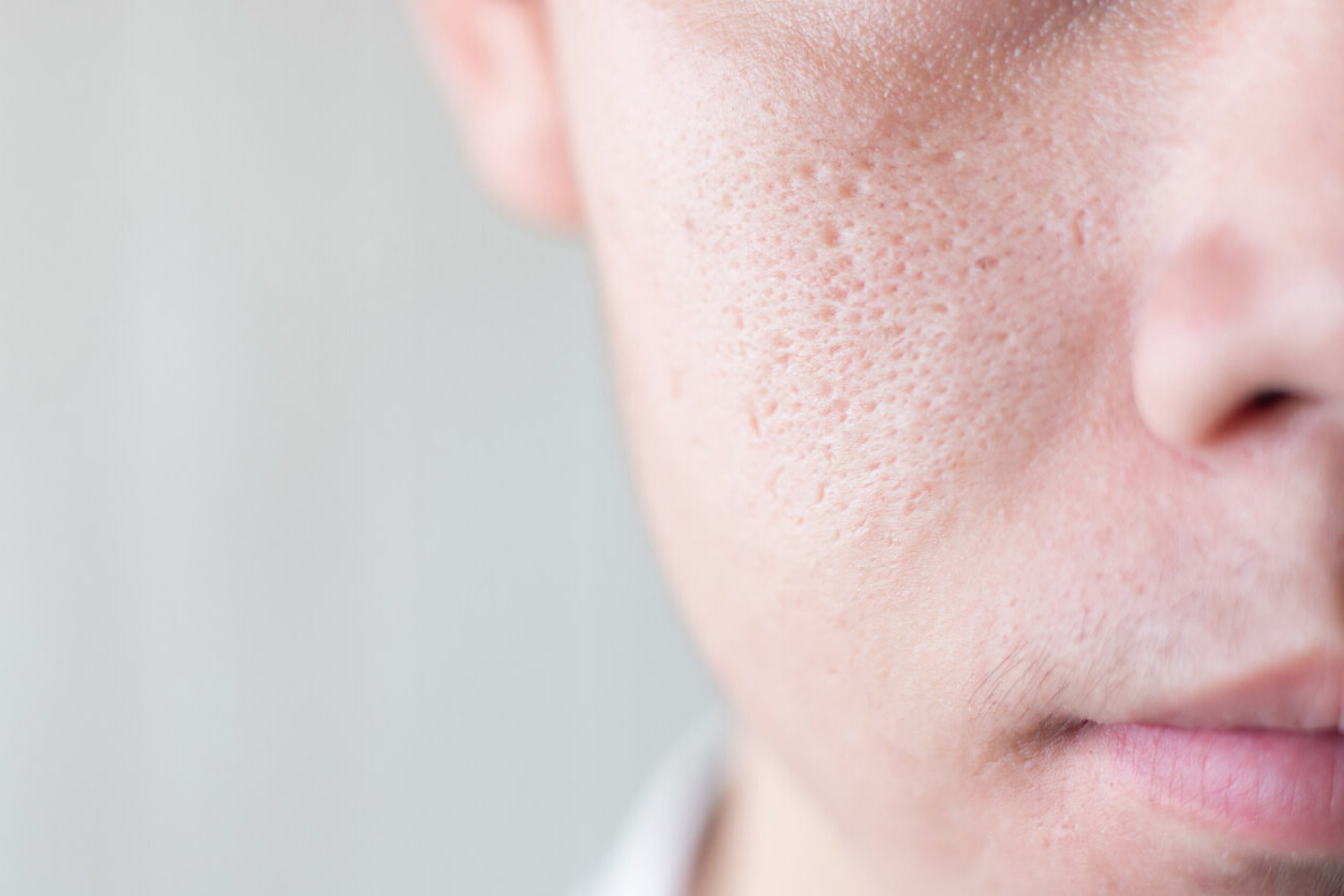 50-facts-about-pores