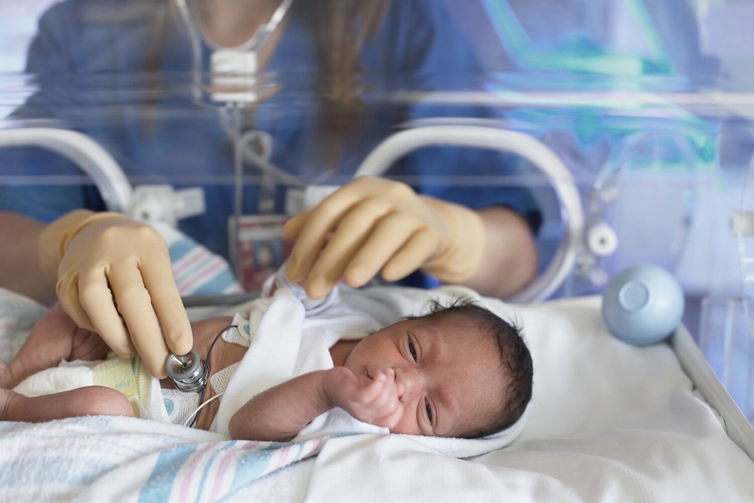 14-facts-about-nicu